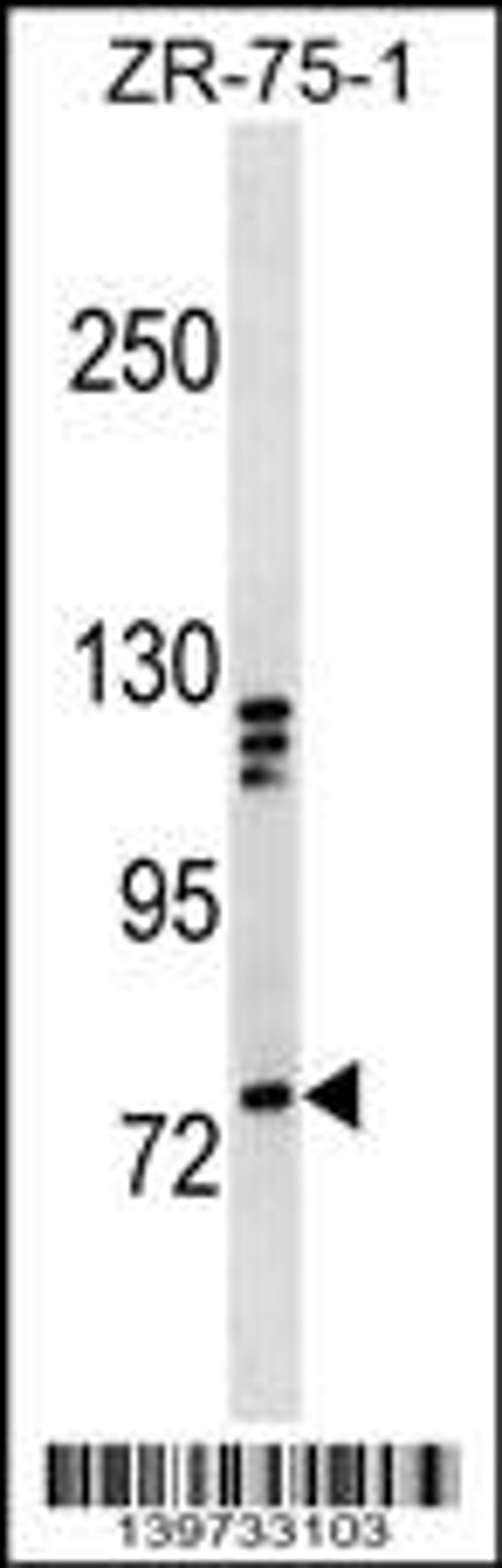 Western blot analysis in ZR-75-1 cell line lysates (35ug/lane).