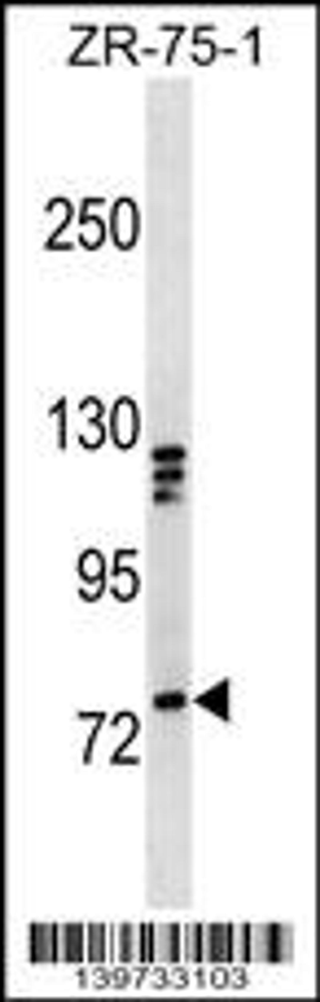 Western blot analysis in ZR-75-1 cell line lysates (35ug/lane).