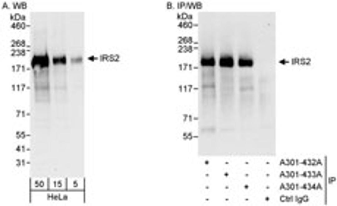 Detection of human IRS2 by western blot and immunoprecipitation.