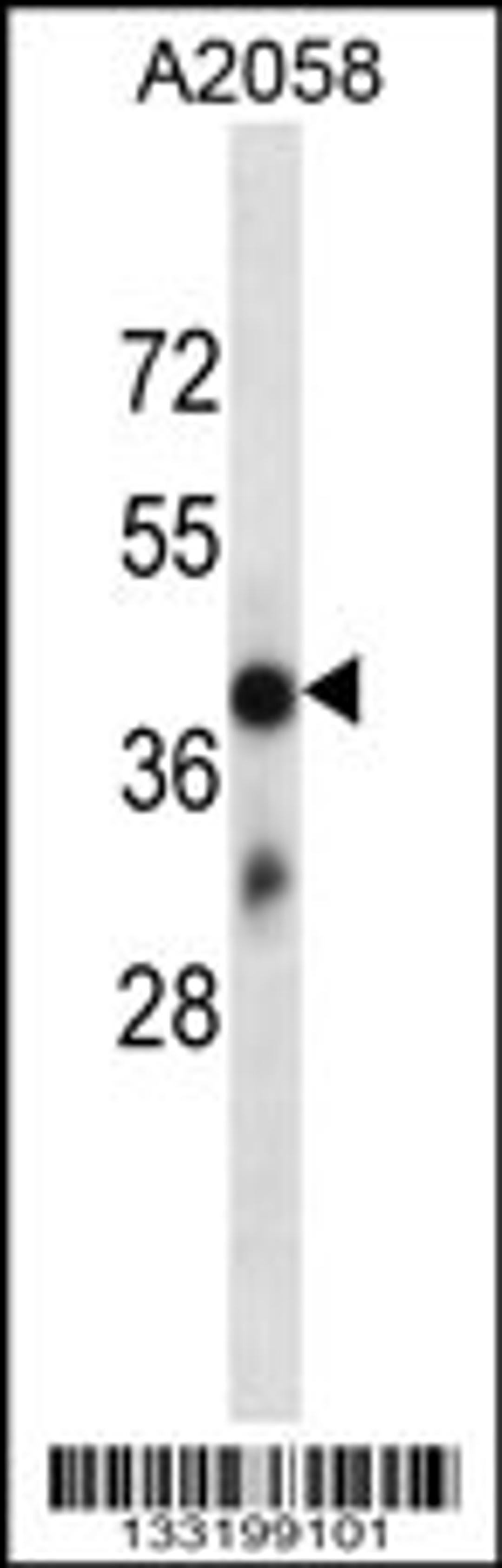 Western blot analysis in A2058 cell line lysates (35ug/lane).