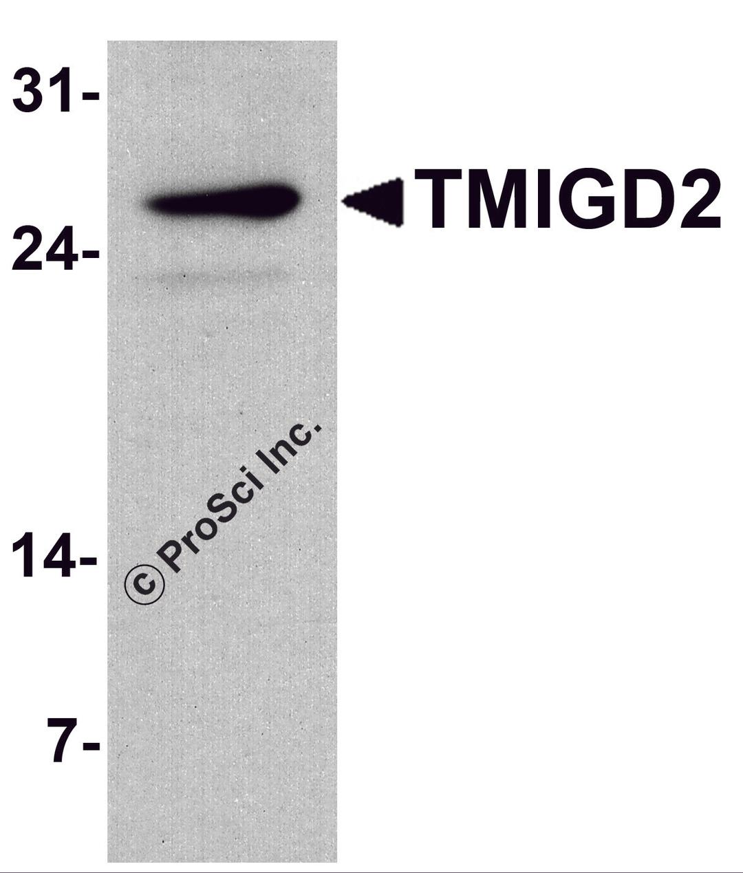 Western blot analysis of TMIGD2 in mouse small intestine tissue lysate with TMIGD2 antibody at 1 μg/ml.
