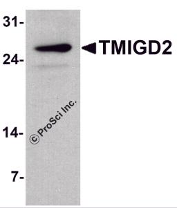Western blot analysis of TMIGD2 in mouse small intestine tissue lysate with TMIGD2 antibody at 1 μg/ml.