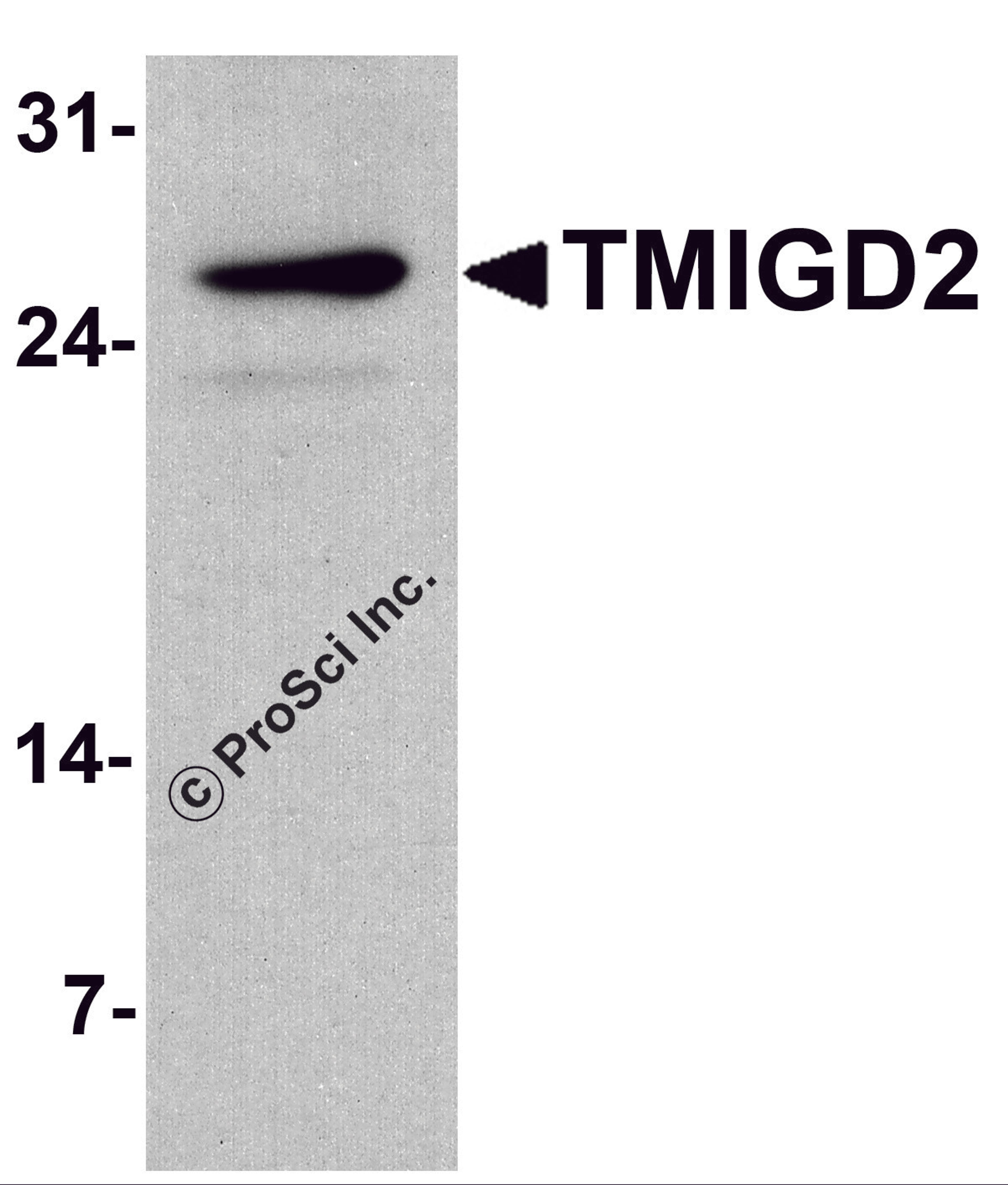 Western blot analysis of TMIGD2 in mouse small intestine tissue lysate with TMIGD2 antibody at 1 μg/ml.