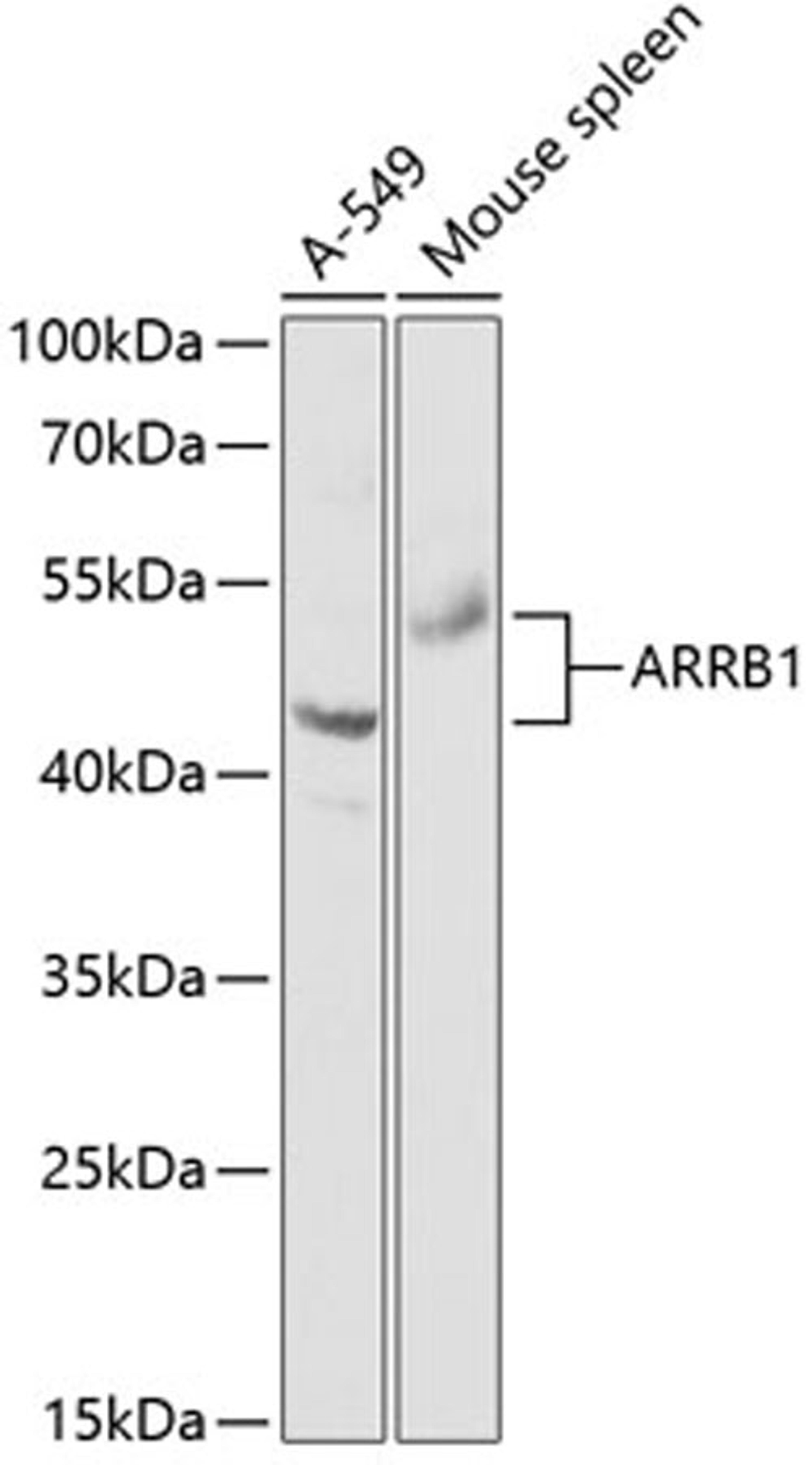 Western blot - ARRB1 antibody (A0190)