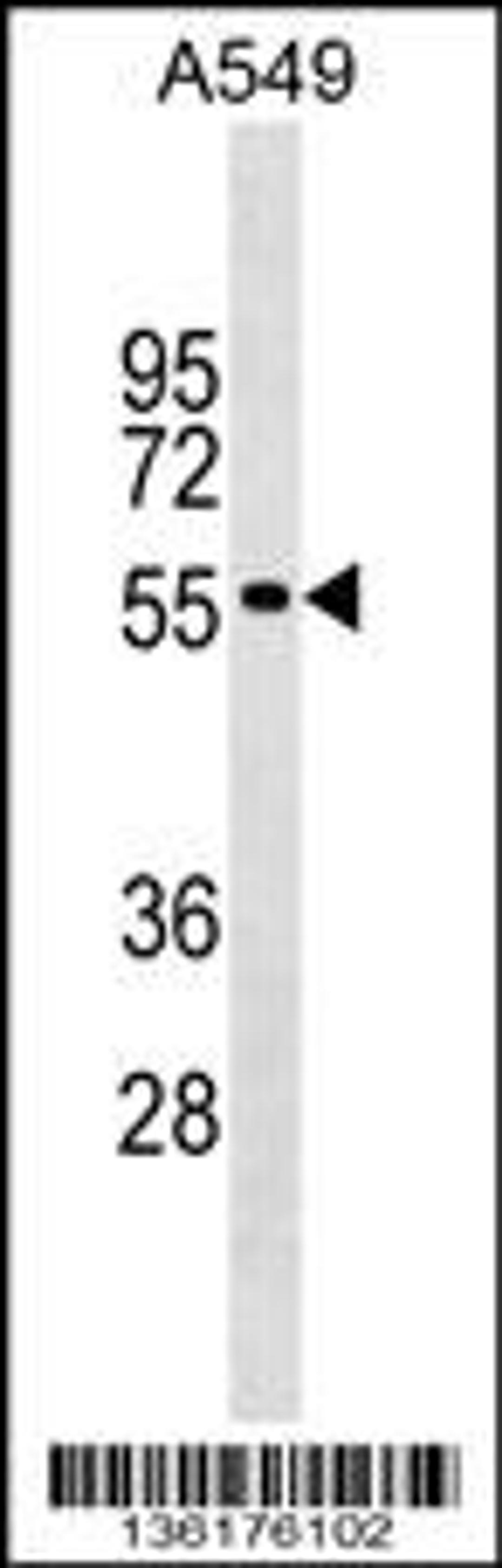 Western blot analysis in A549 cell line lysates (35ug/lane).