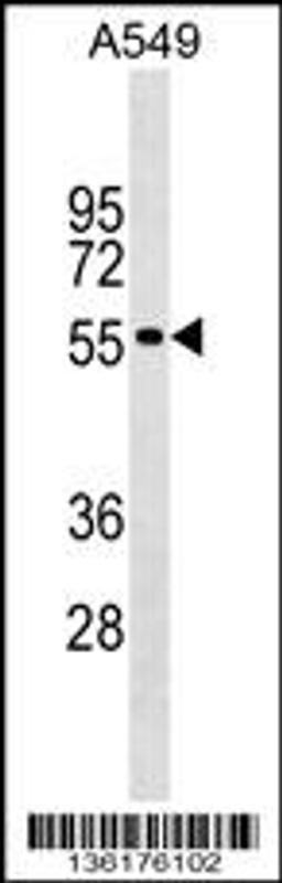 Western blot analysis in A549 cell line lysates (35ug/lane).