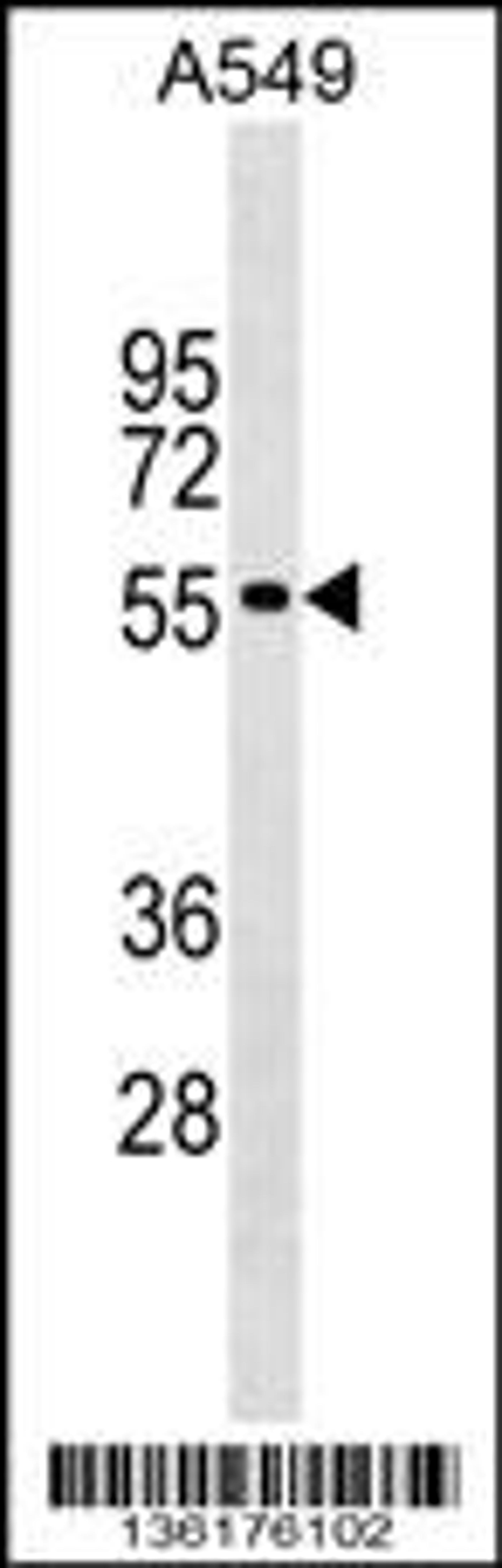 Western blot analysis in A549 cell line lysates (35ug/lane).