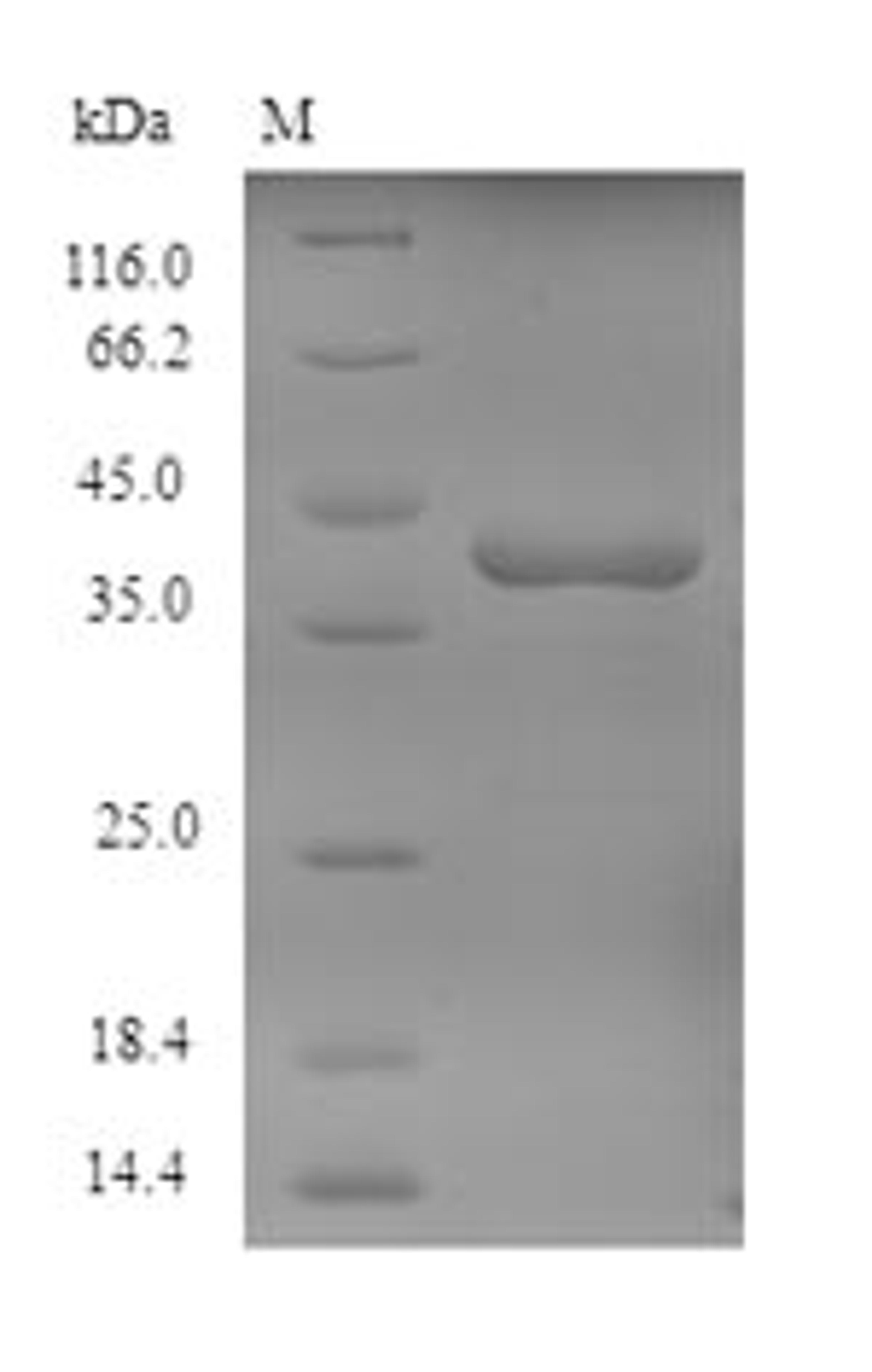 (Tris-Glycine gel) Discontinuous SDS-PAGE (reduced) with 5% enrichment gel and 15% separation gel.