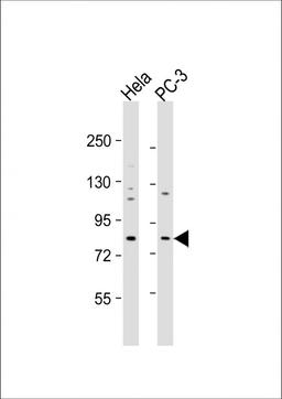 Western Blot at 1:1000 dilution Lane 1: Hela whole cell lysate Lane 2: PC-3 whole cell lysate Lysates/proteins at 20 ug per lane.