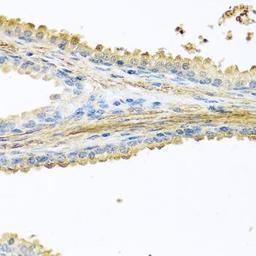 Immunohistochemical staining of rat lung tissue using PIP antibody (dilution of 1:100)