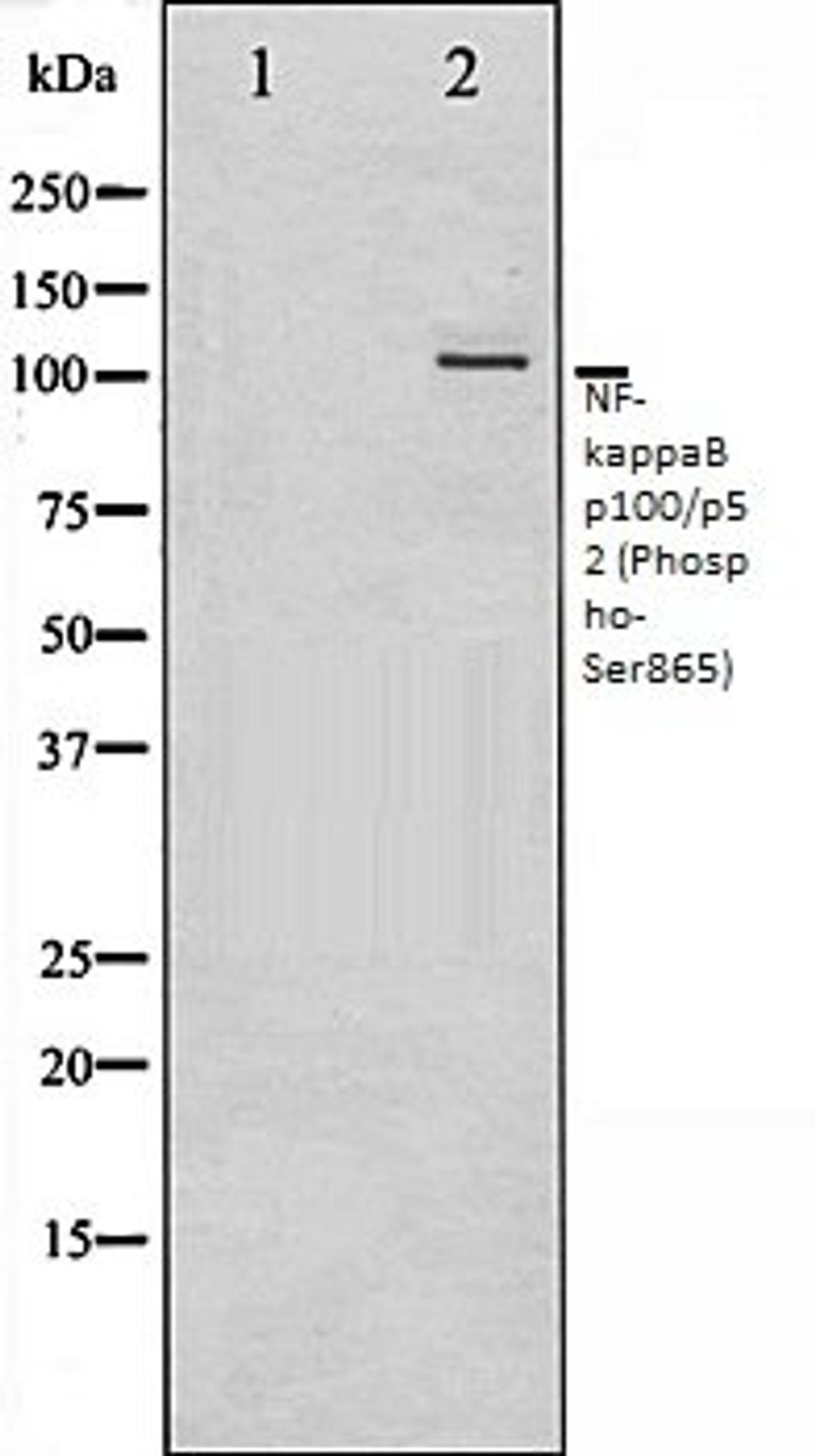 Western blot analysis of ovarycancer whole cell lysates using NF- kappaB p100/p52 (Phospho-Ser865) antibody, The lane on the left is treated with the antigen-specific peptide.