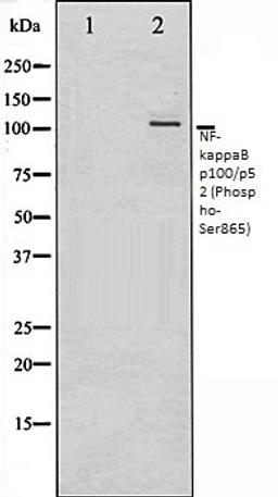 Western blot analysis of ovarycancer whole cell lysates using NF- kappaB p100/p52 (Phospho-Ser865) antibody, The lane on the left is treated with the antigen-specific peptide.