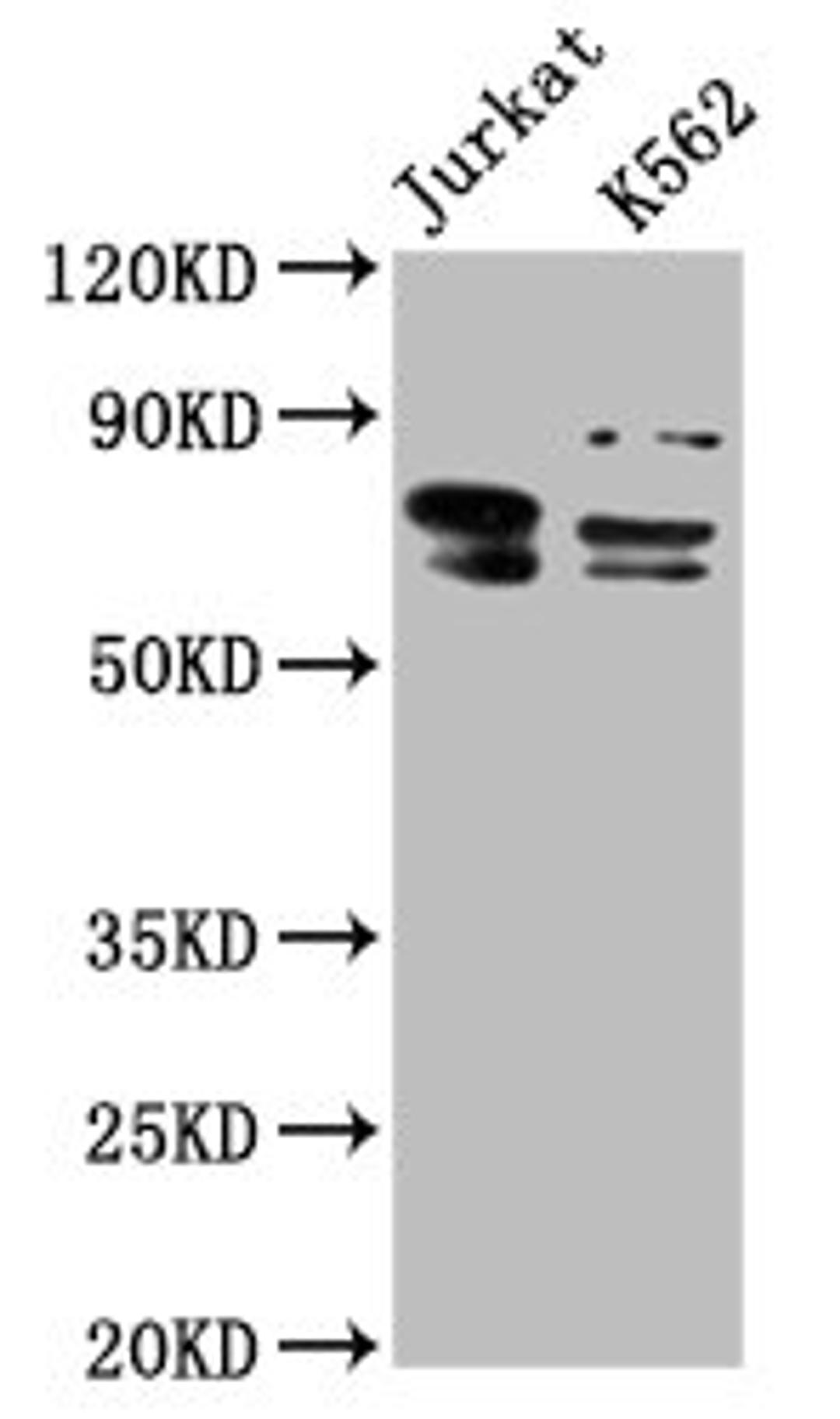 Western Blot. Positive WB detected in: Jurkat whole cell lysate, K562 whole cell lysate. All lanes: THEMIS antibody at 7.6µg/ml. Secondary. Goat polyclonal to rabbit IgG at 1/50000 dilution. Predicted band size: 74, 70, 63, 78 kDa. Observed band size: 74, 70 kDa