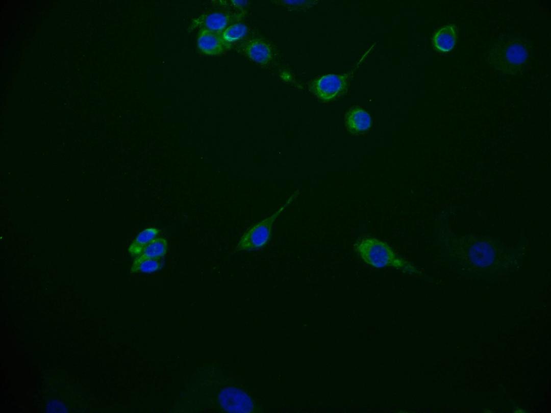 Immunofluorescence staining of MCF-7 cell with CSB-RA172768A0HU at 1:50, counter-stained with DAPI. The cells were fixed in 4% formaldehyde and blocked in 10% normal Goat Serum. The cells were then incubated with the antibody overnight at 4°C. The secondary antibody was Alexa Fluor 536-congugated AffiniPure Goat Anti-Rabbit IgG(H+L).