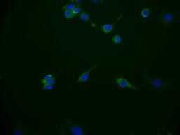 Immunofluorescence staining of MCF-7 cell with CSB-RA172768A0HU at 1:50, counter-stained with DAPI. The cells were fixed in 4% formaldehyde and blocked in 10% normal Goat Serum. The cells were then incubated with the antibody overnight at 4°C. The secondary antibody was Alexa Fluor 536-congugated AffiniPure Goat Anti-Rabbit IgG(H+L).