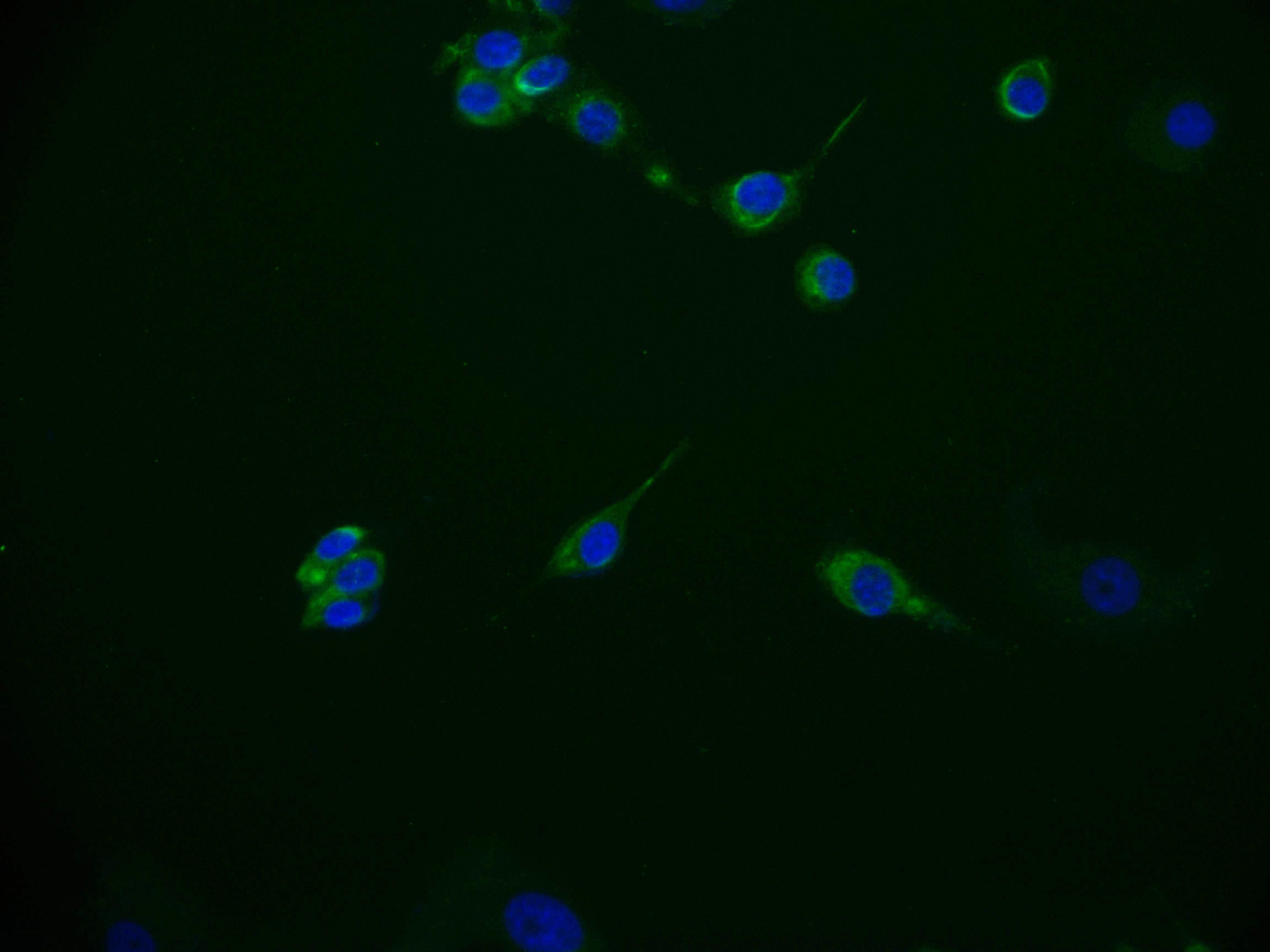 Immunofluorescence staining of MCF-7 cell with CSB-RA172768A0HU at 1:50, counter-stained with DAPI. The cells were fixed in 4% formaldehyde and blocked in 10% normal Goat Serum. The cells were then incubated with the antibody overnight at 4°C. The secondary antibody was Alexa Fluor 536-congugated AffiniPure Goat Anti-Rabbit IgG(H+L).