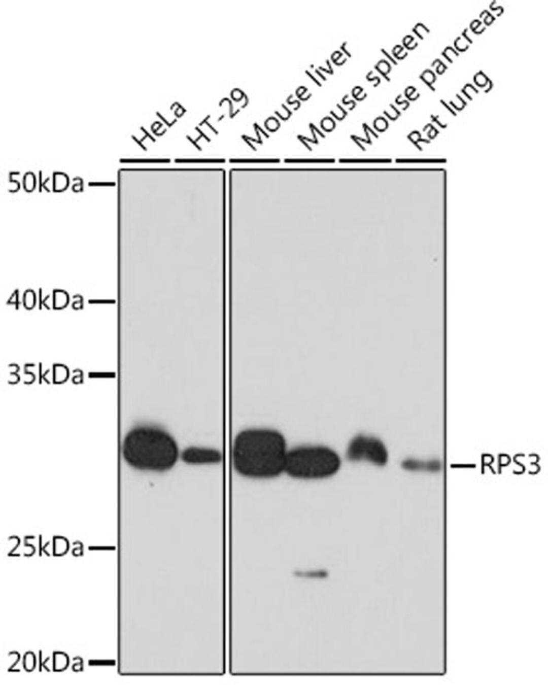 Western blot - RPS3 Rabbit mAb (A4872)