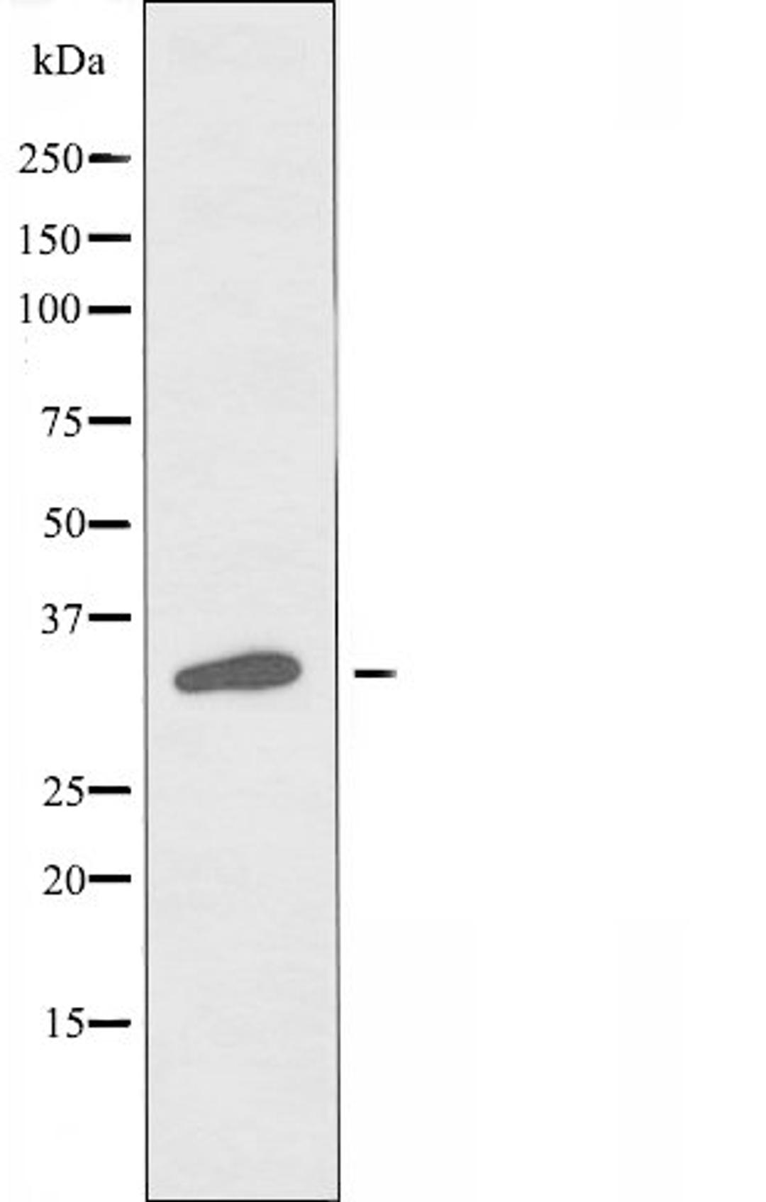 Western blot analysis of Jurkat cells and HepG2 cells using TAS2R45 antibody