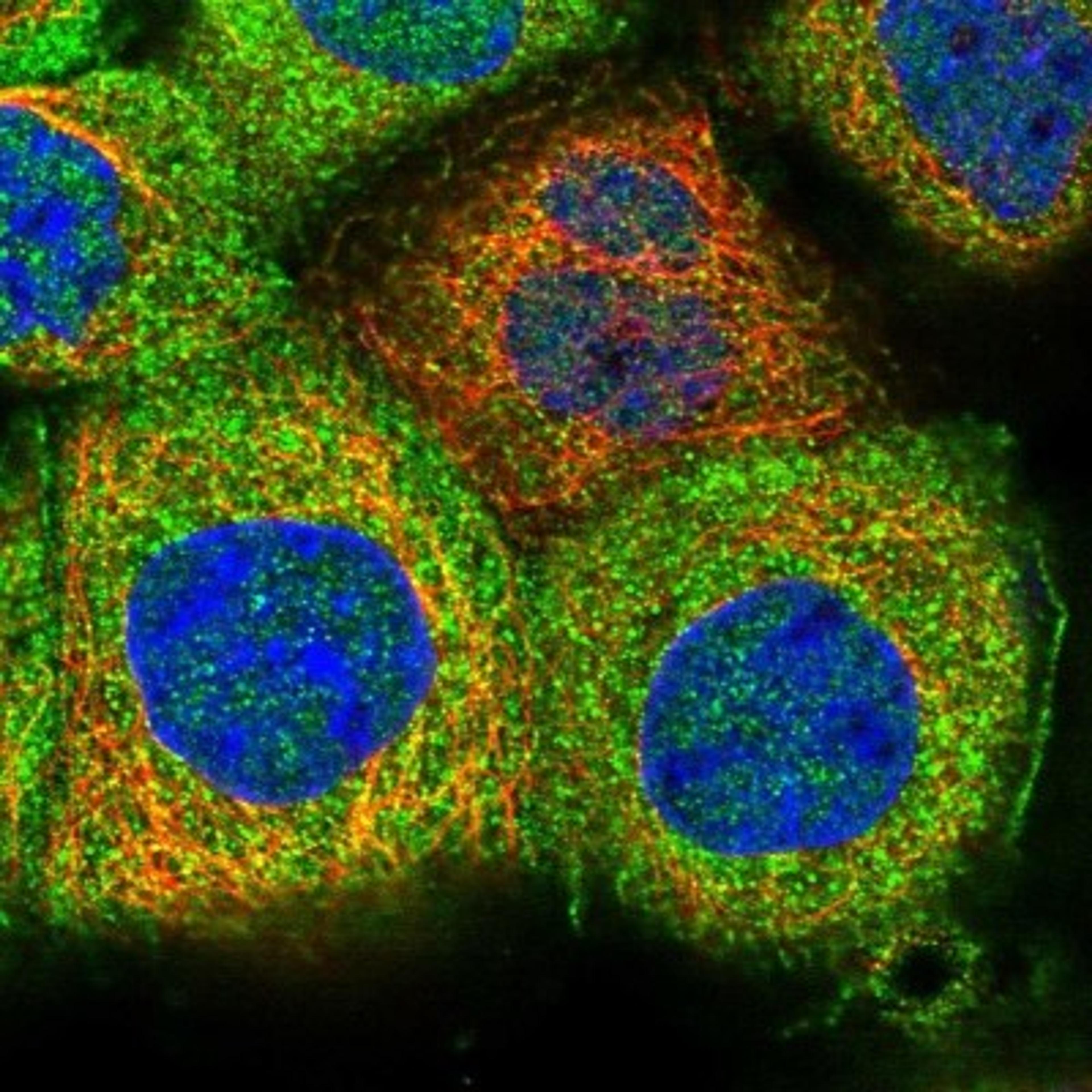 Immunocytochemistry/Immunofluorescence: MKRN3 Antibody [NBP1-84320] - Staining of human cell line A-431 shows positivity in nucleus but not nucleoli, plasma membrane & cytoplasm.