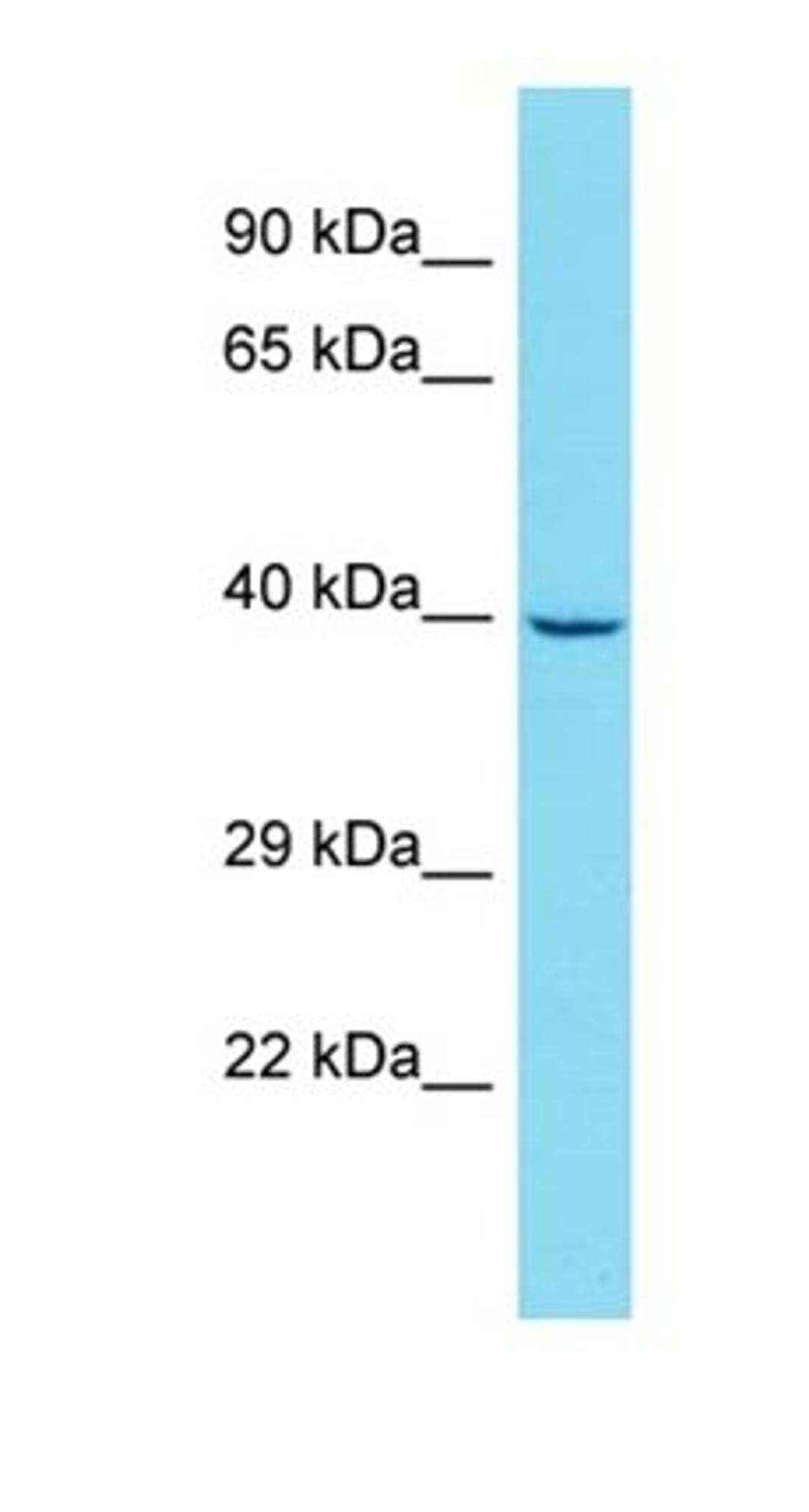 Western blot analysis of HepG2 tissue using GATSL3 antibody