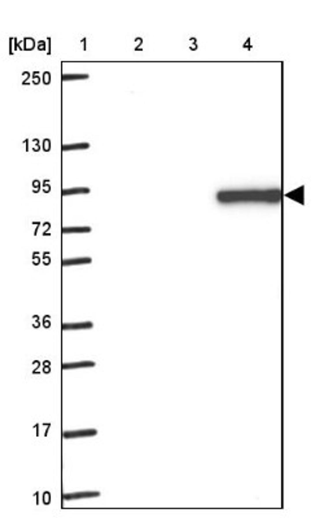 Western Blot: F2 Antibody [NBP2-33728] - Lane 1: Marker [kDa] 250, 130, 95, 72, 55, 36, 28, 17, 10<br/>Lane 2: Human cell line RT-4<br/>Lane 3: Human cell line U-251MG sp<br/>Lane 4: Human plasma (IgG/HSA depleted)