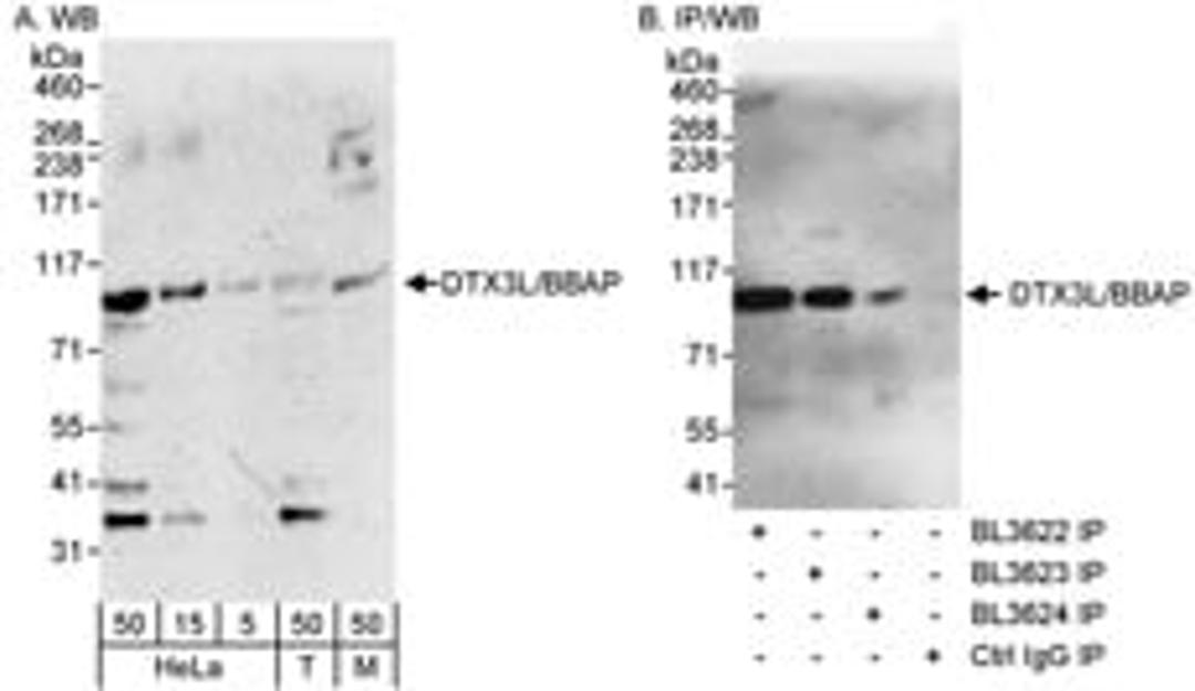 Detection of human and mouse DTX3L/BBAP by western blot (h&m) and immunoprecipitation (h).