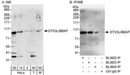 Detection of human and mouse DTX3L/BBAP by western blot (h&m) and immunoprecipitation (h).