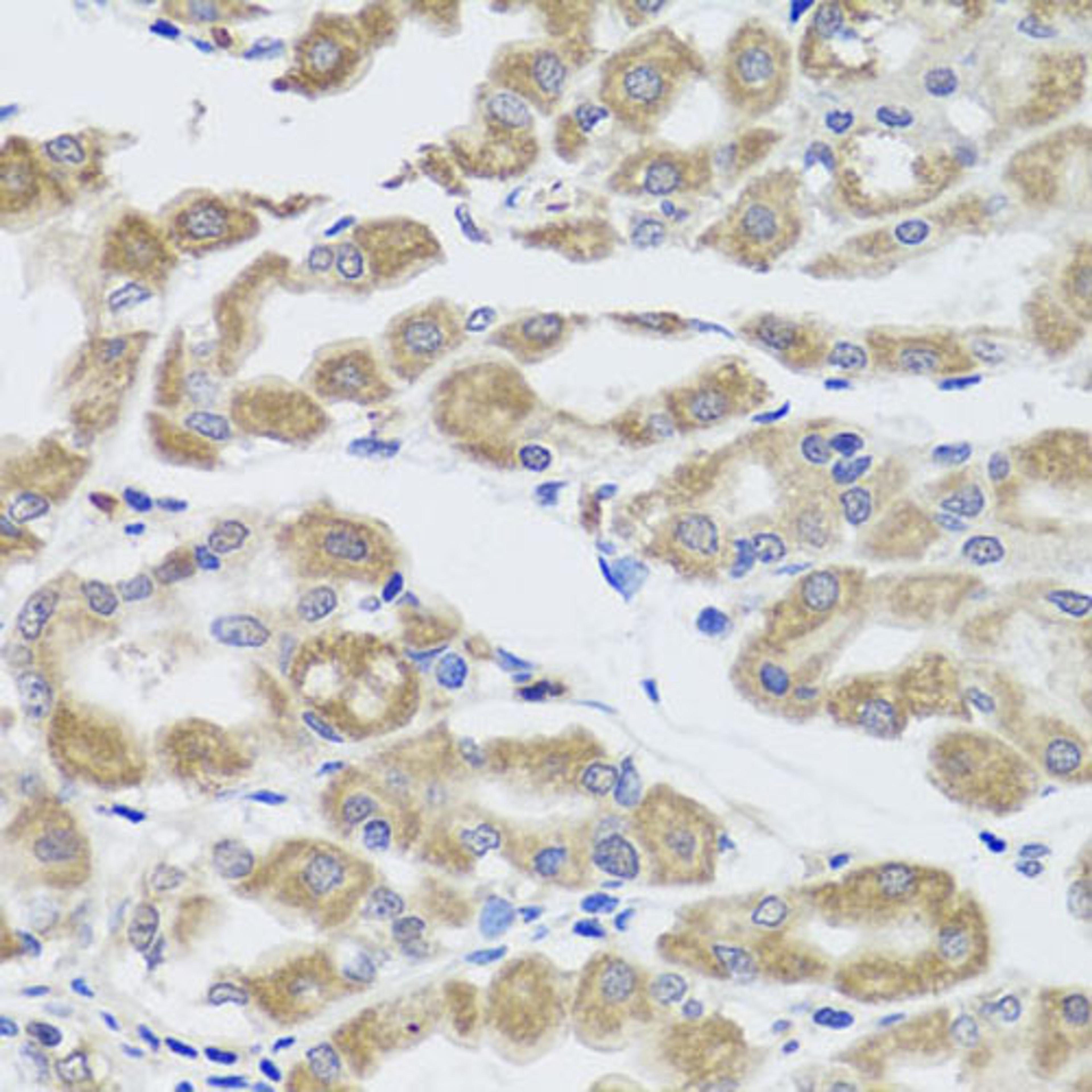 Western blot - KLK3 antibody (A2052)