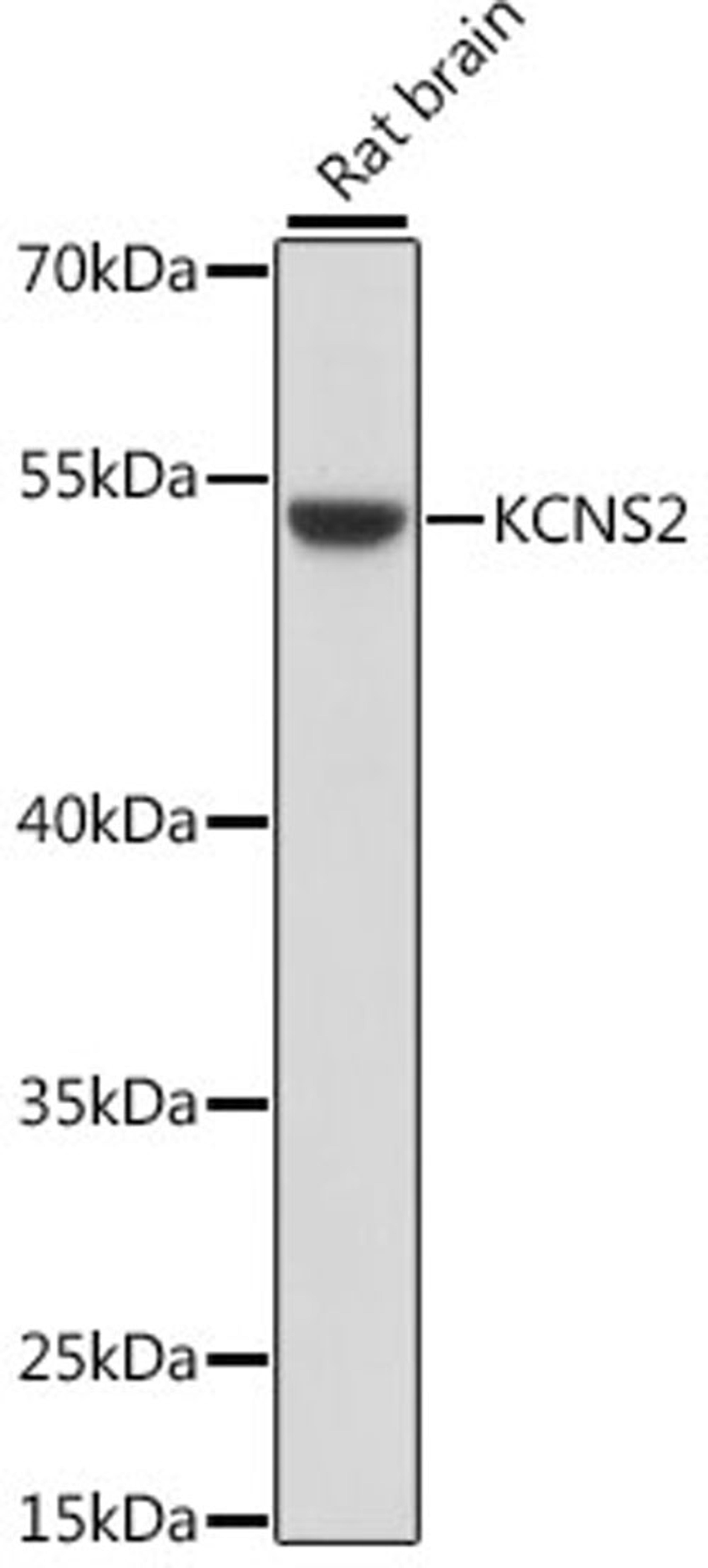 Western blot - KCNS2 antibody (A15684)