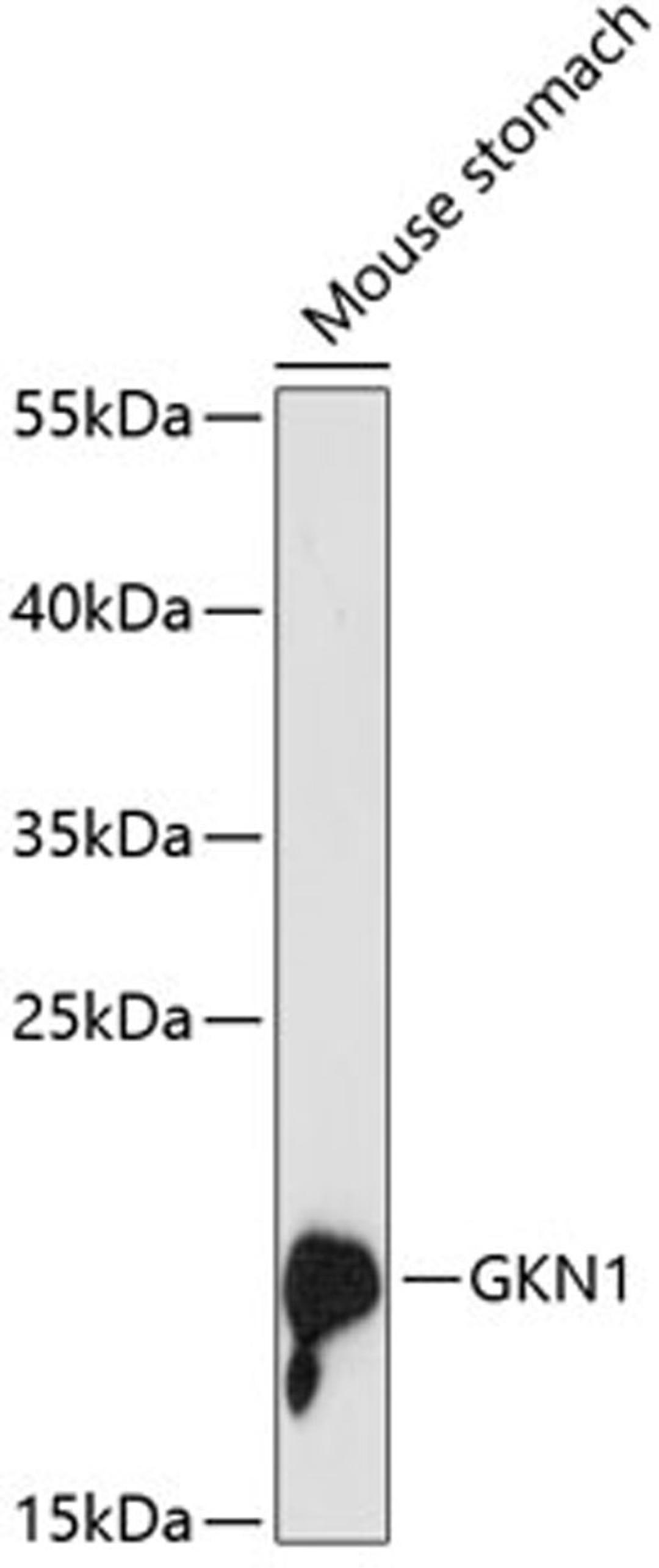 Western blot - GKN1 antibody (A13107)