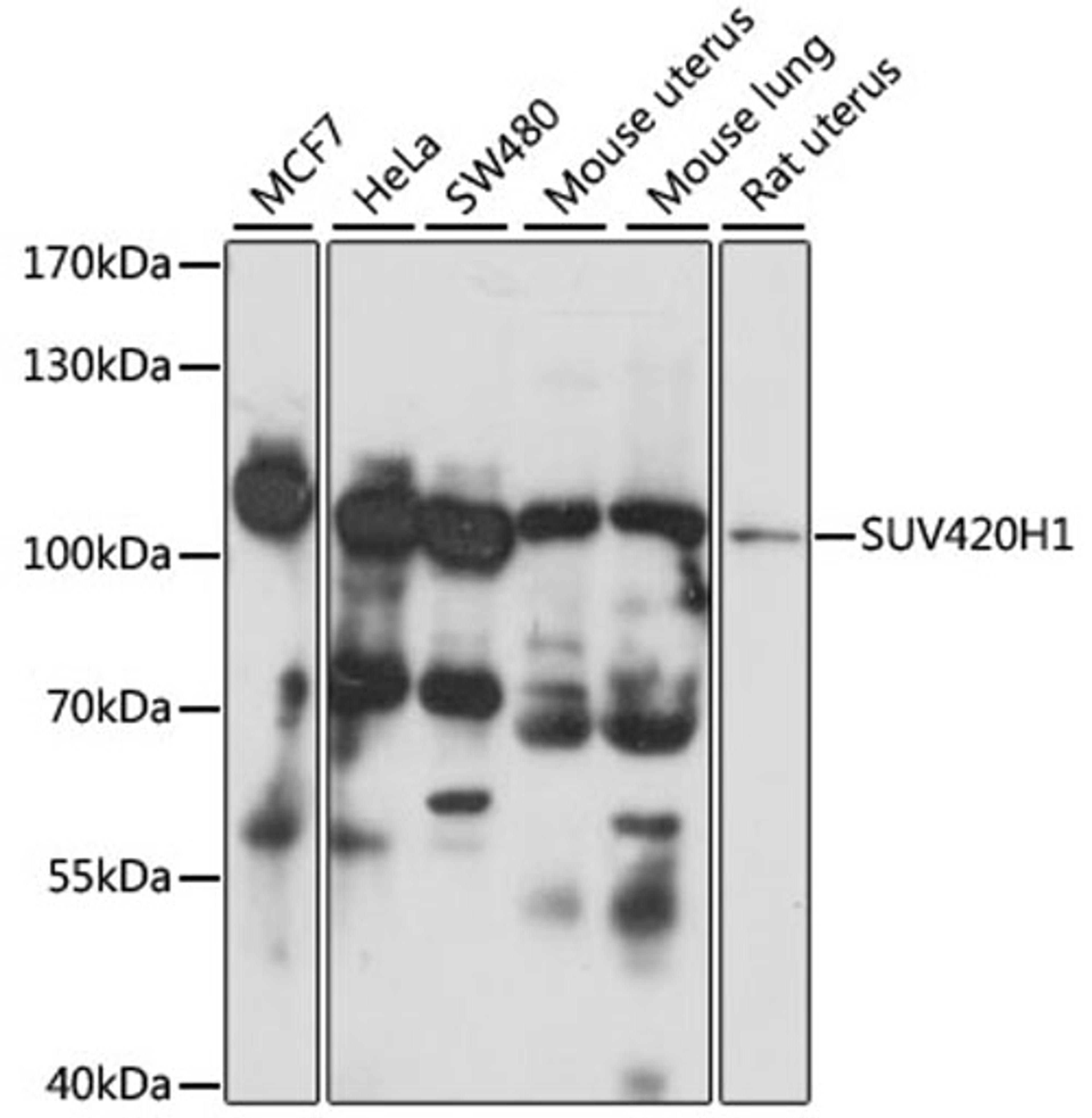 Western blot - SUV420H1 antibody (A15442)