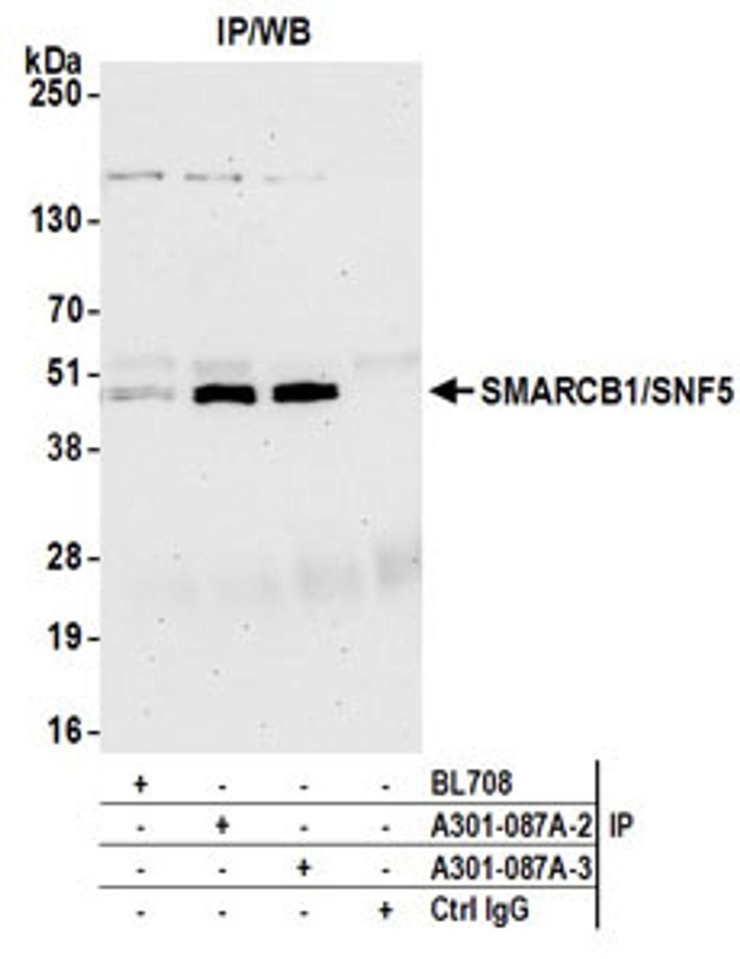 Detection of human SMARCB1/SNF5 by western blot of immunoprecipitates.