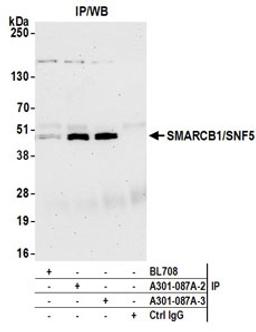 Detection of human SMARCB1/SNF5 by western blot of immunoprecipitates.