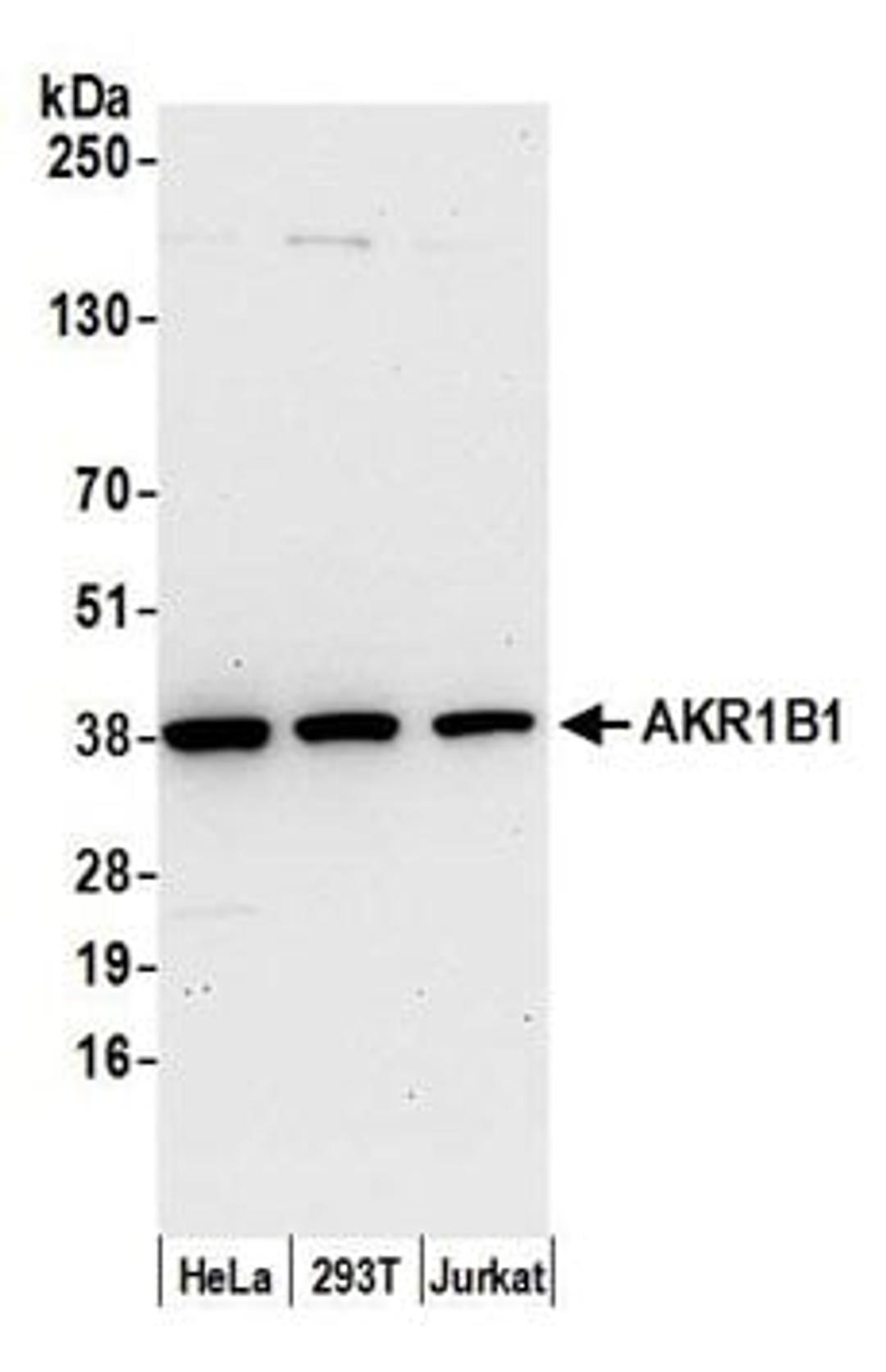 Detection of human AKR1B1 by western blot.