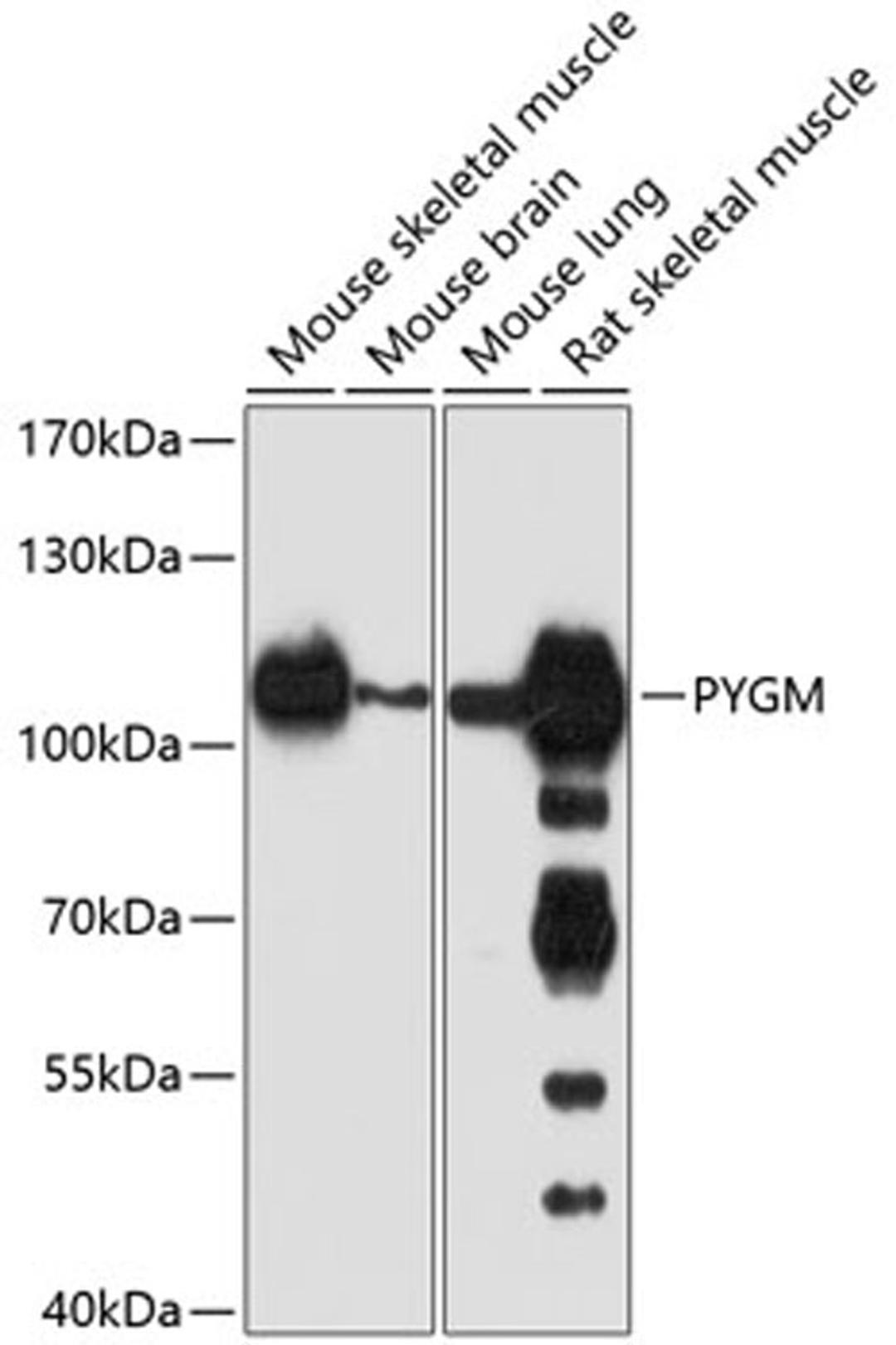 Western blot - PYGM antibody (A9392)