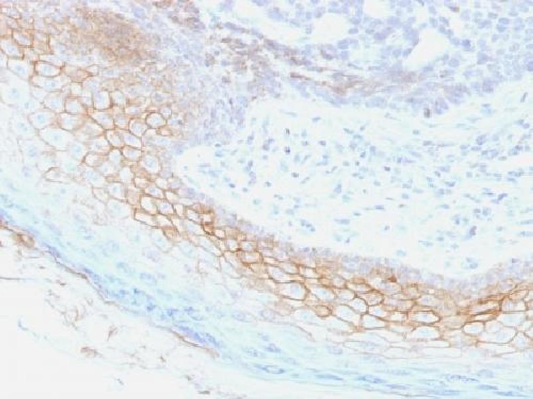 Immunohistochemical staining of human Skin tissue using DSC2 antibody