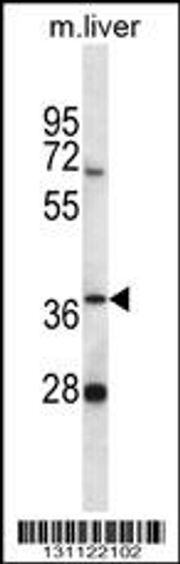 Western blot analysis in mouse liver tissue lysates (35ug/lane).