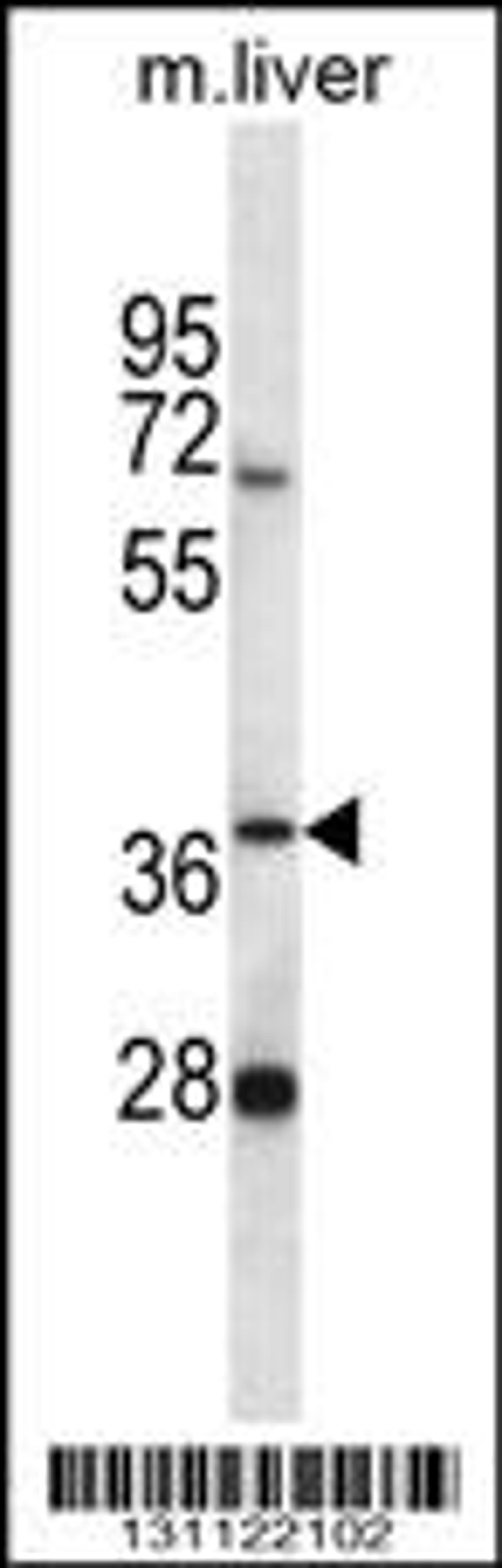 Western blot analysis in mouse liver tissue lysates (35ug/lane).