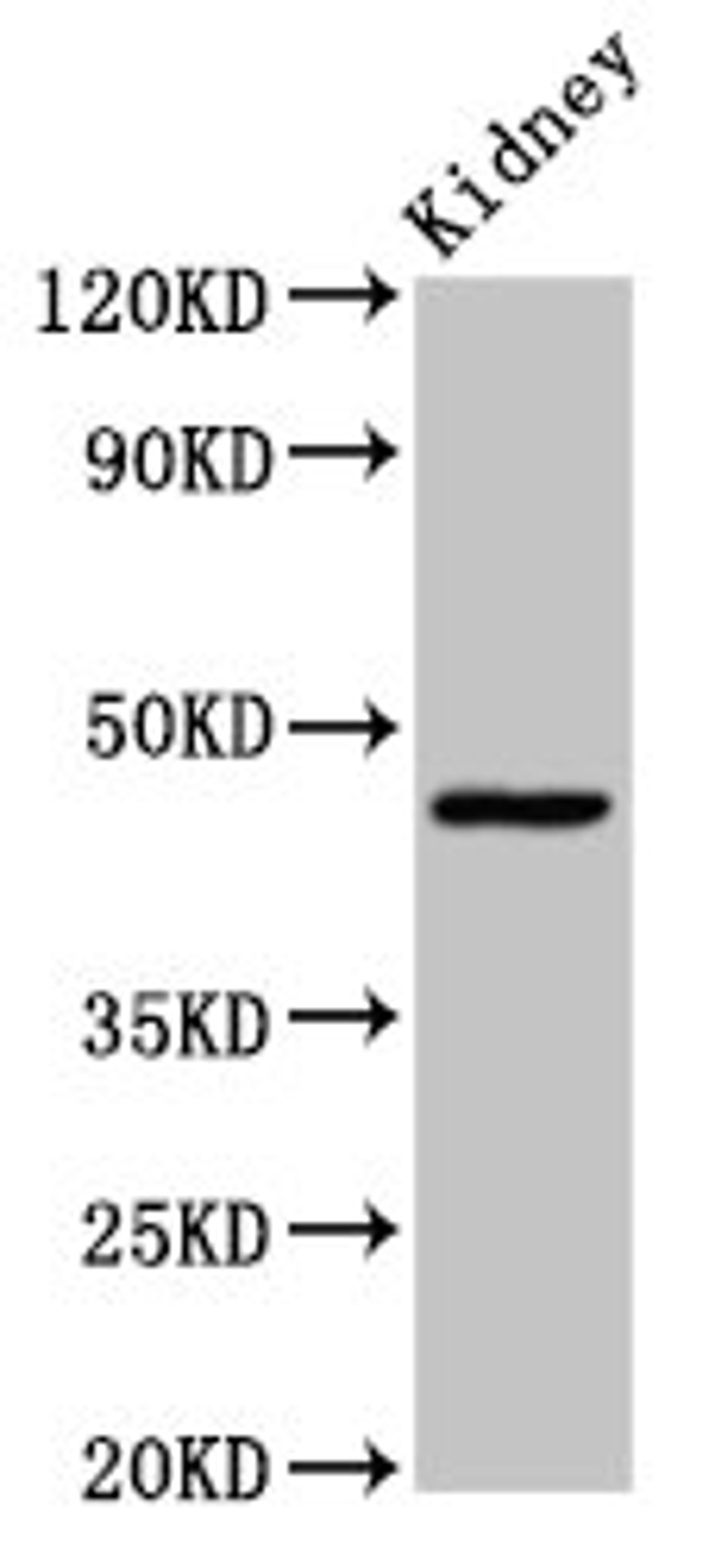 Western Blot. Positive WB detected in: Rat kidney tissue. All lanes: COX15 antibody at 3.4ug/ml. Secondary. Goat polyclonal to rabbit IgG at 1/50000 dilution. Predicted band size: 47, 44 kDa. Observed band size: 47 kDa. 