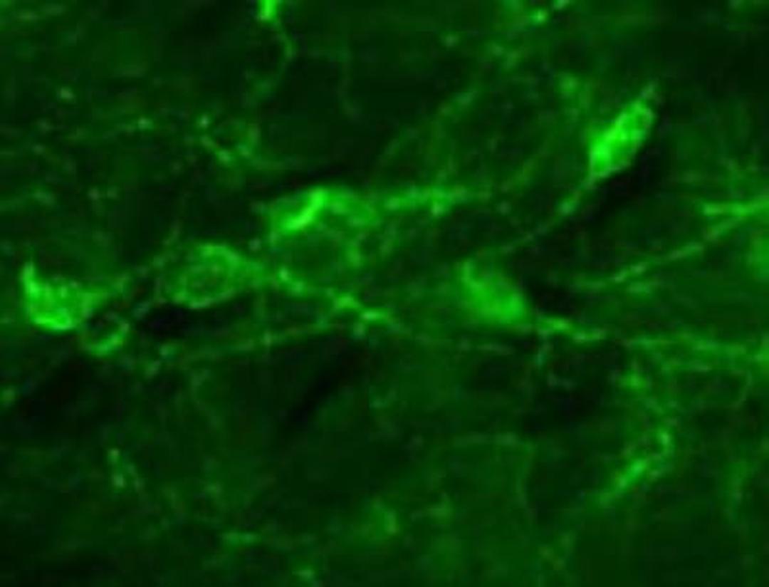 Immunocytochemistry/Immunofluorescence: NGF R/TNFRSF16/p75NTR Antibody (mc-192) [NBP2-36729] - Analysis using the FITC conjugate of NBP2-36729. Staining of rat basal forebrain cholinergic neurons.