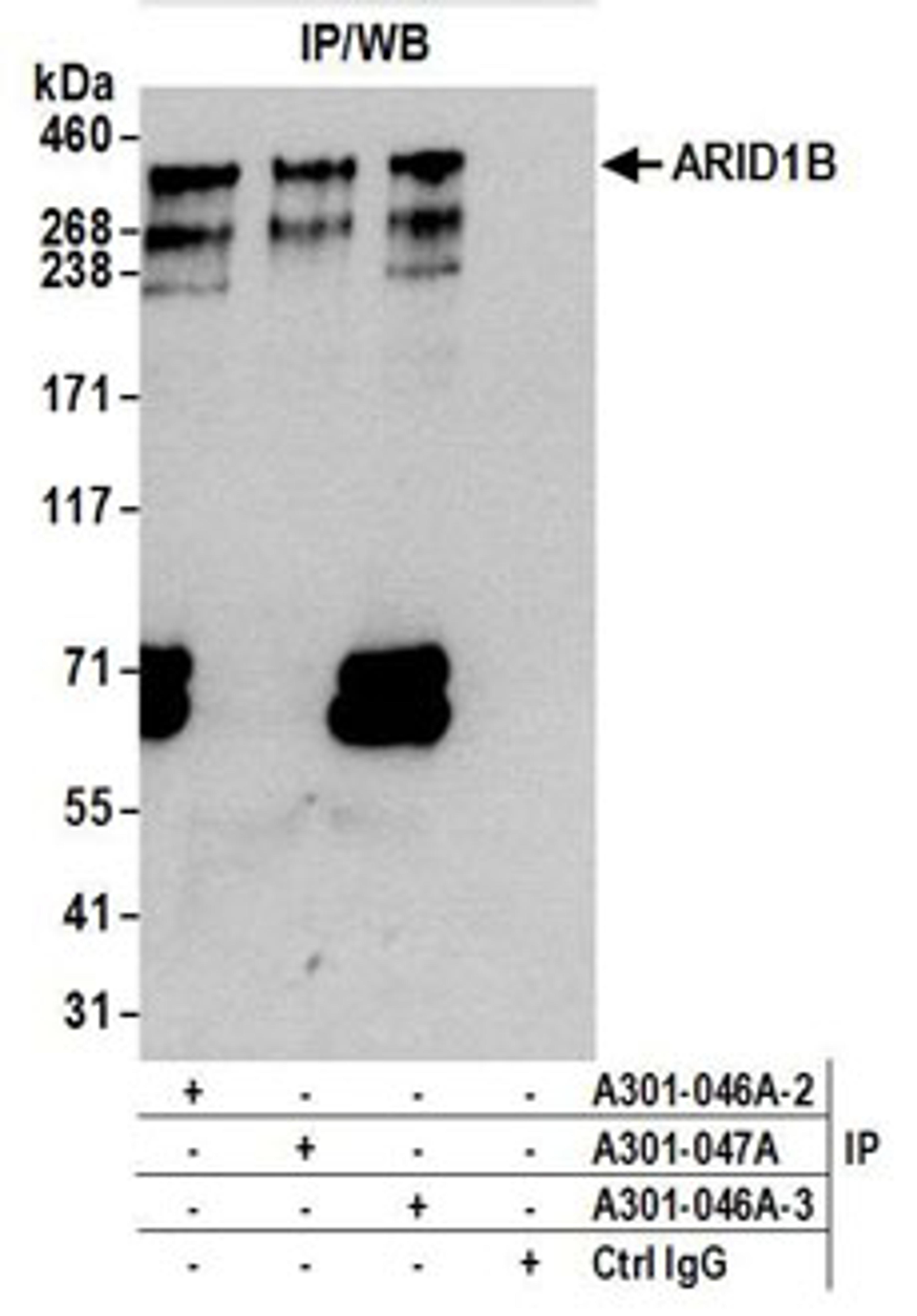 Detection of human ARID1B by western blot of immunoprecipitates.