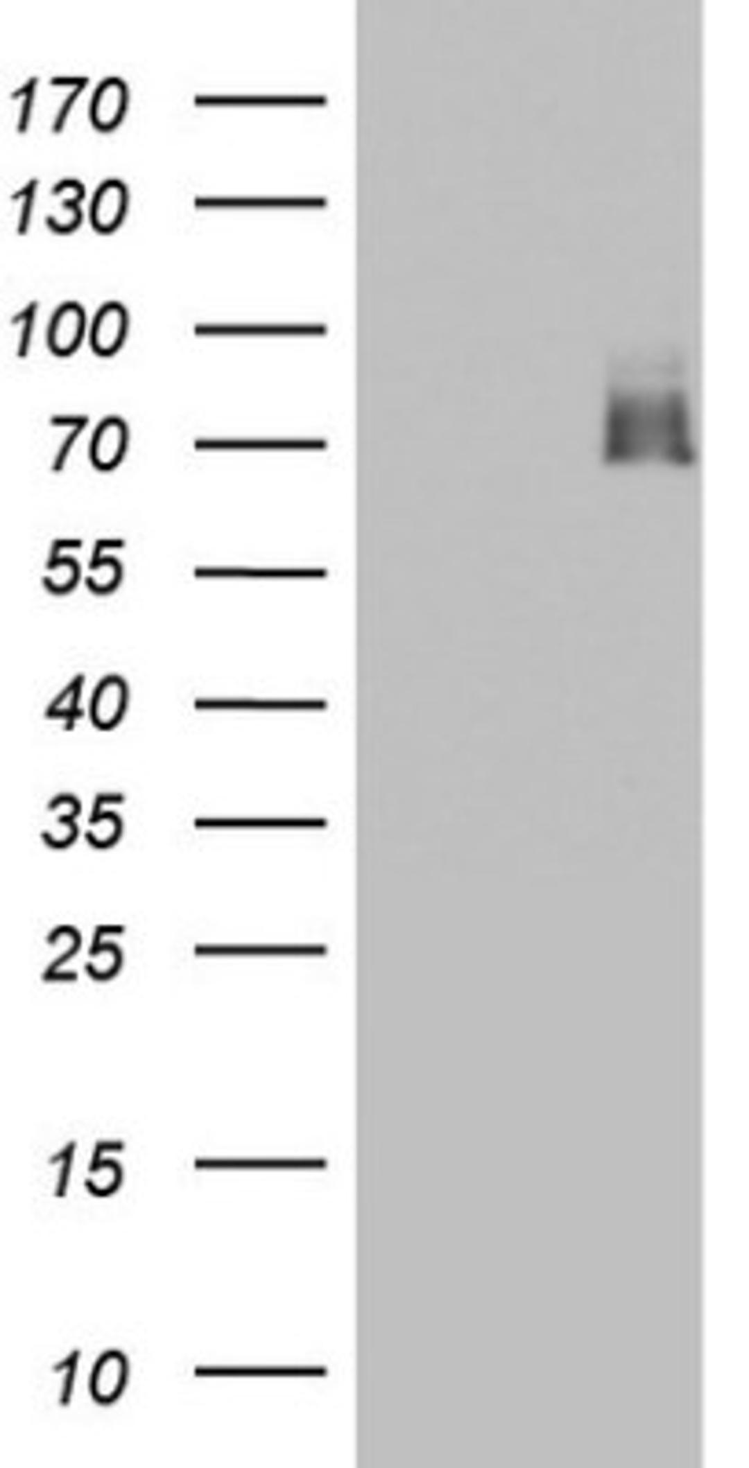 Western Blot: A-RAF Antibody (2G9) [NBP2-46538] - Analysis of HEK293T cells were transfected with the pCMV6-ENTRY control (Left lane) or pCMV6-ENTRY ARAF.