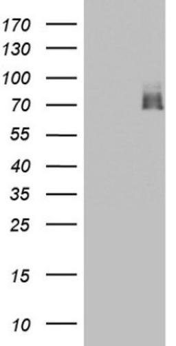 Western Blot: A-RAF Antibody (2G9) [NBP2-46538] - Analysis of HEK293T cells were transfected with the pCMV6-ENTRY control (Left lane) or pCMV6-ENTRY ARAF.