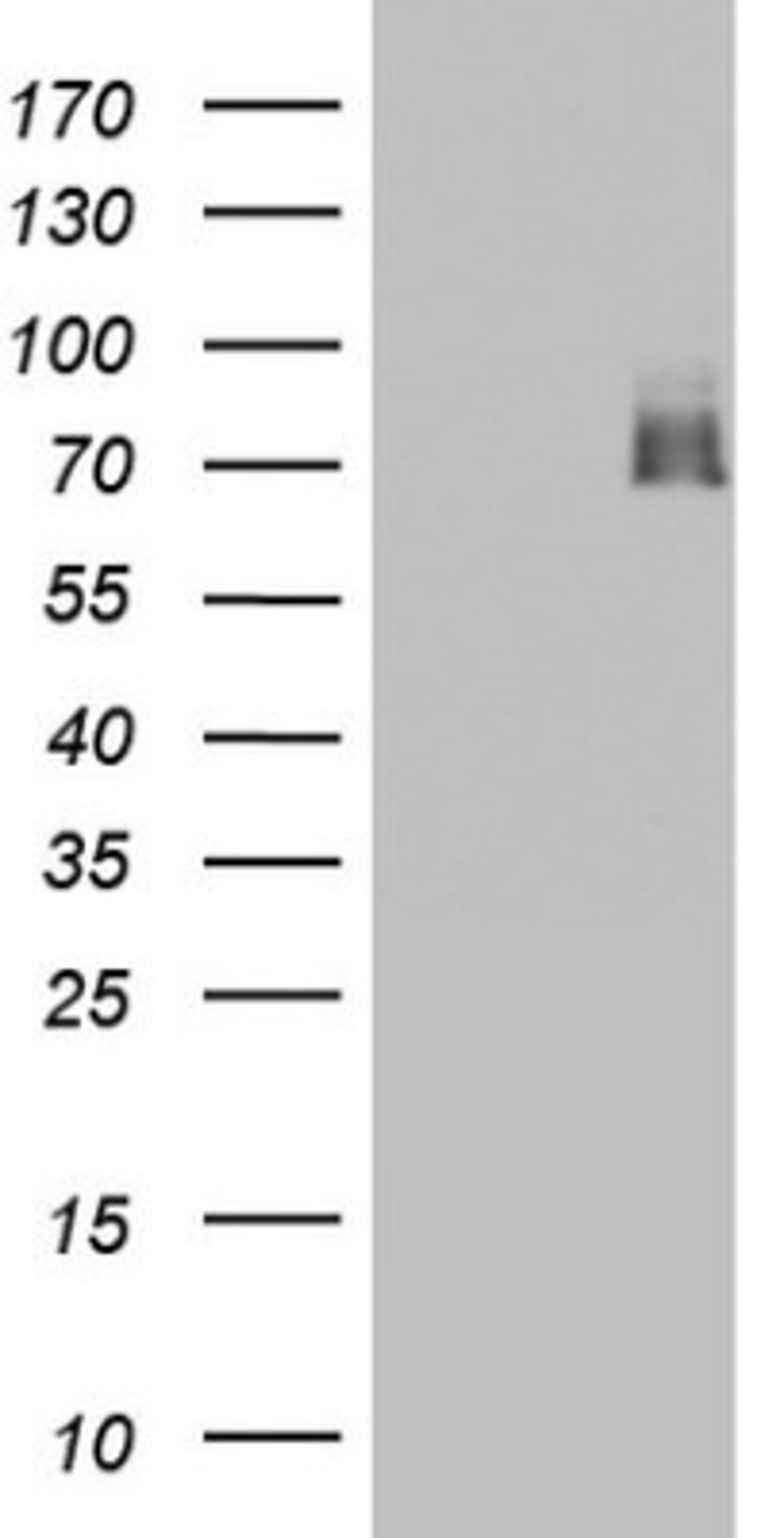 Western Blot: A-RAF Antibody (2G9) [NBP2-46538] - Analysis of HEK293T cells were transfected with the pCMV6-ENTRY control (Left lane) or pCMV6-ENTRY ARAF.