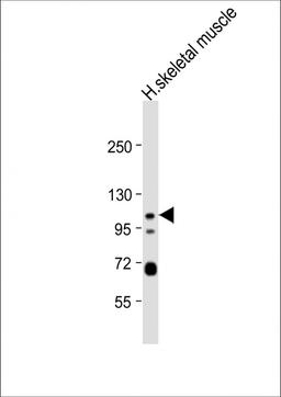 Western Blot at 1:1000 dilution + human skeletal muscle lysate Lysates/proteins at 20 ug per lane.