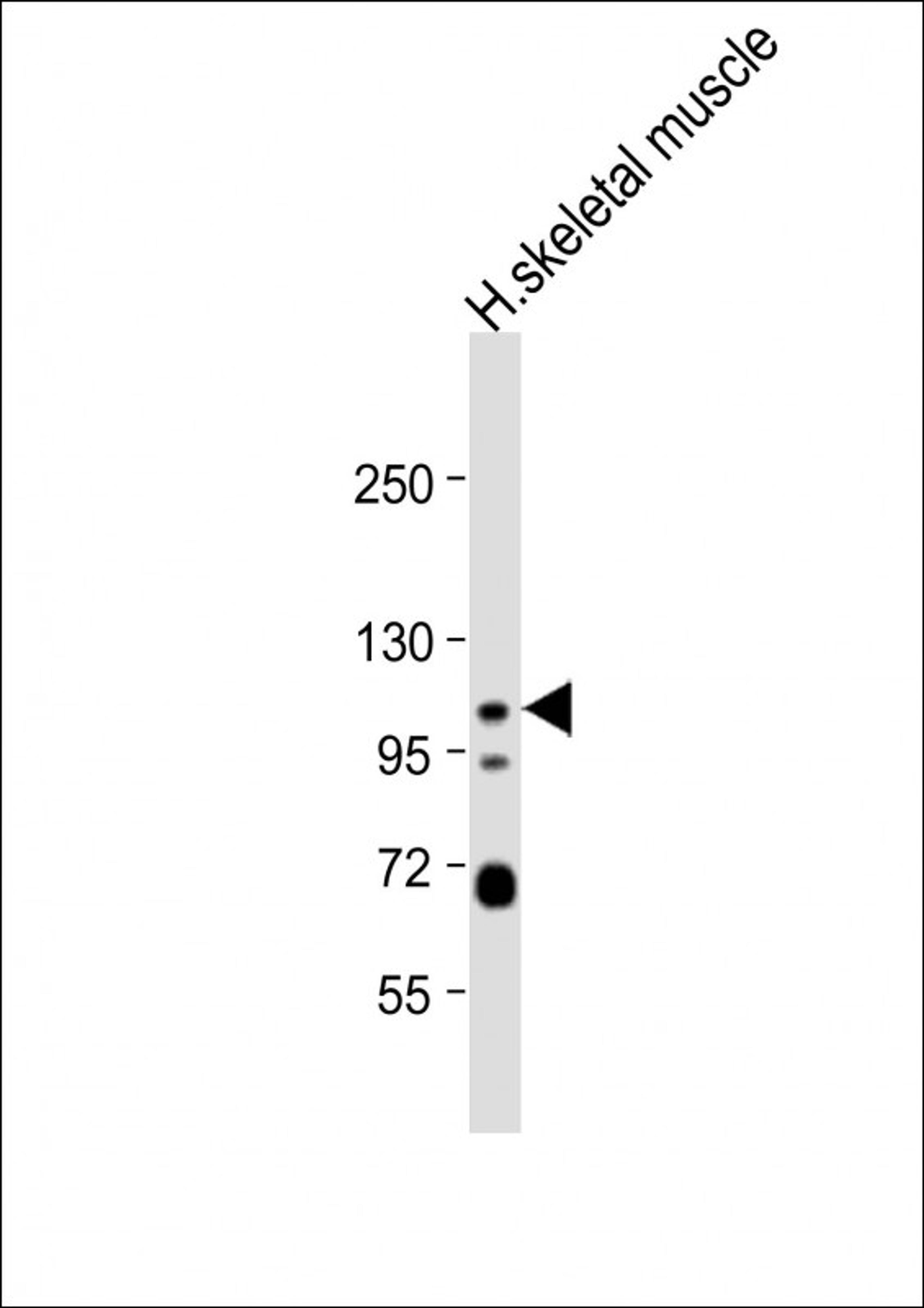 Western Blot at 1:1000 dilution + human skeletal muscle lysate Lysates/proteins at 20 ug per lane.