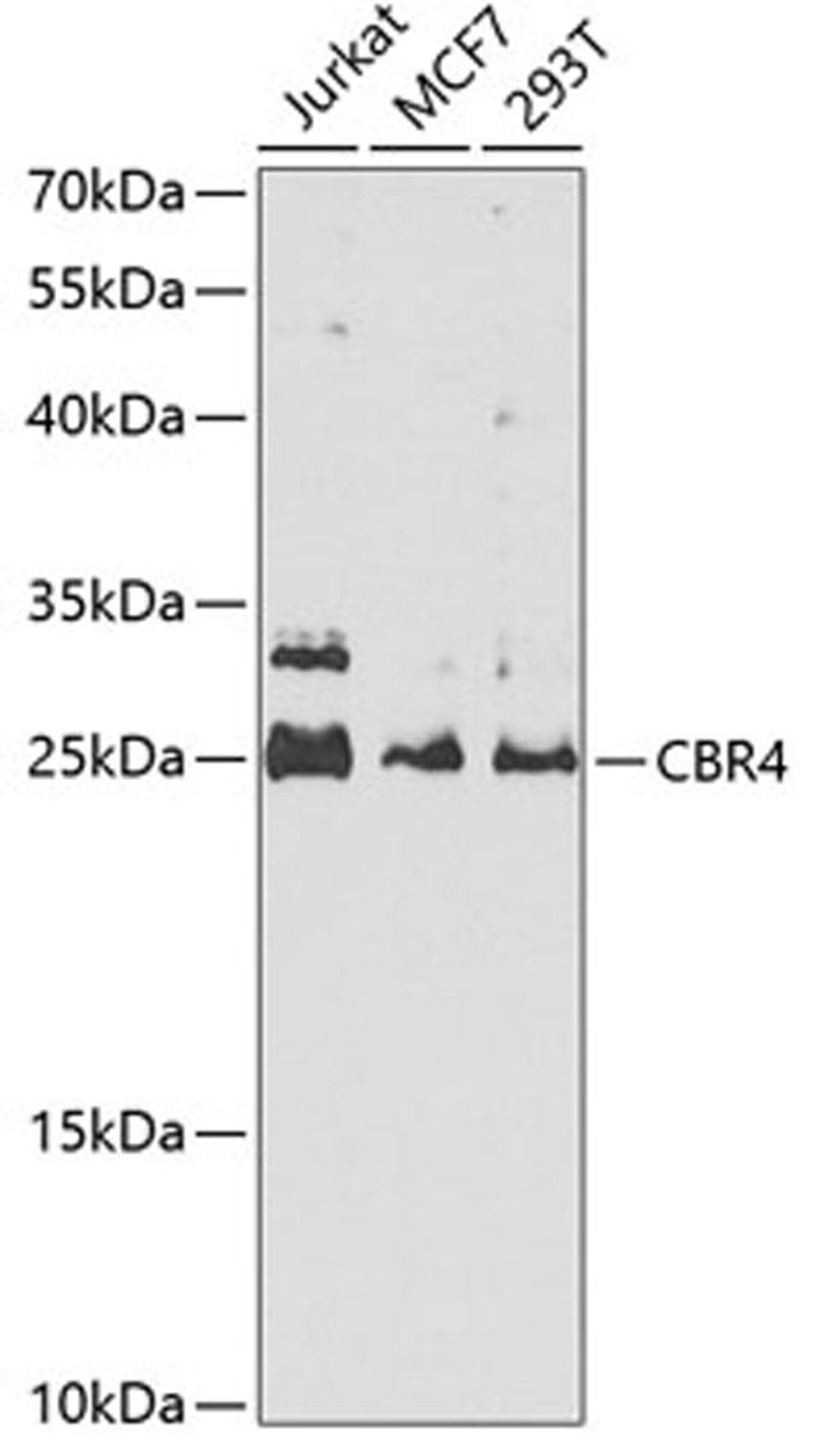 Western blot - CBR4 antibody (A5069)