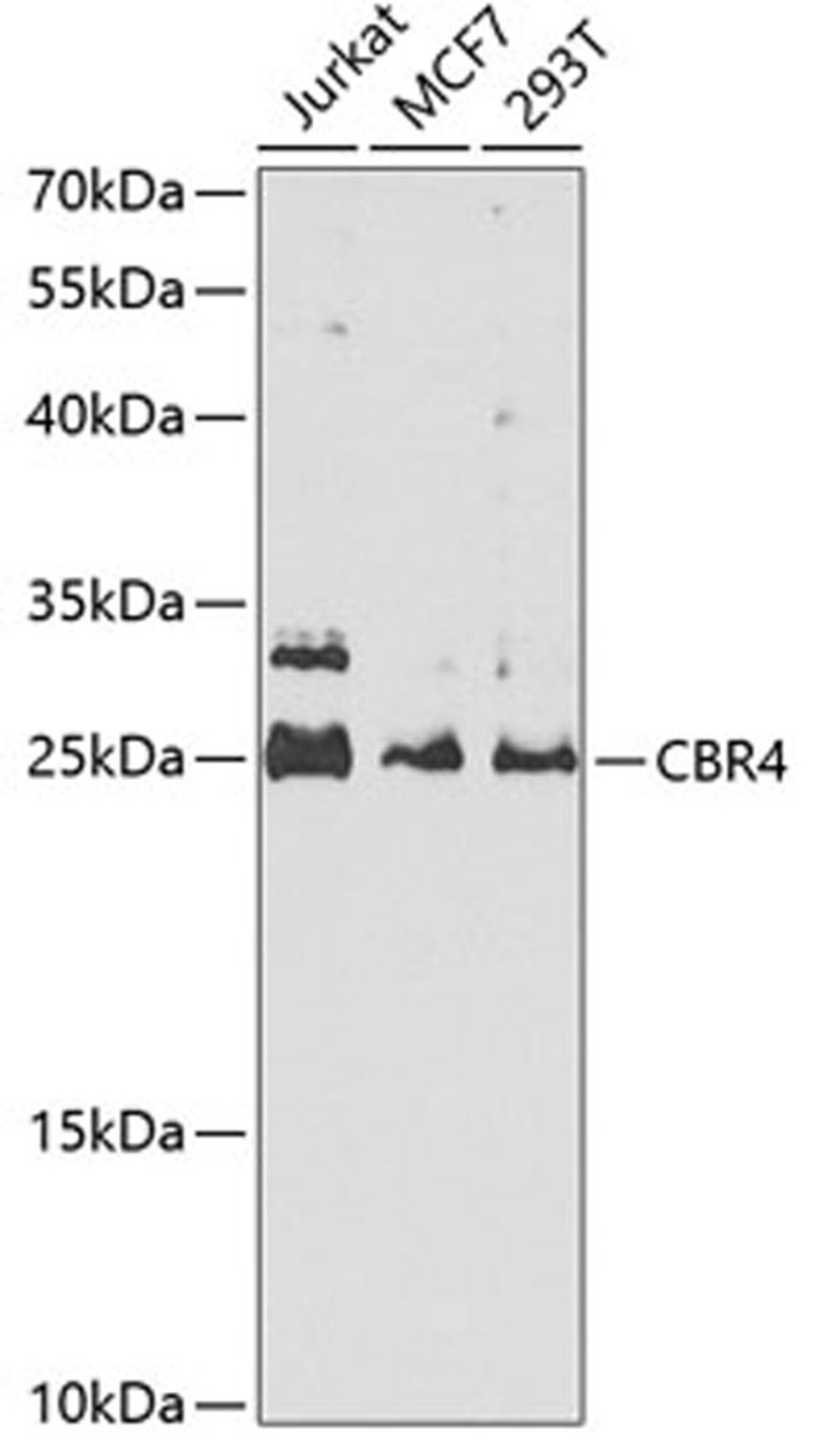 Western blot - CBR4 antibody (A5069)