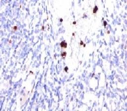 IHC testing of FFPE human tonsil and G-CSF antibody (PRPN2-1). Note cytoplasmic staining of granulocytes.