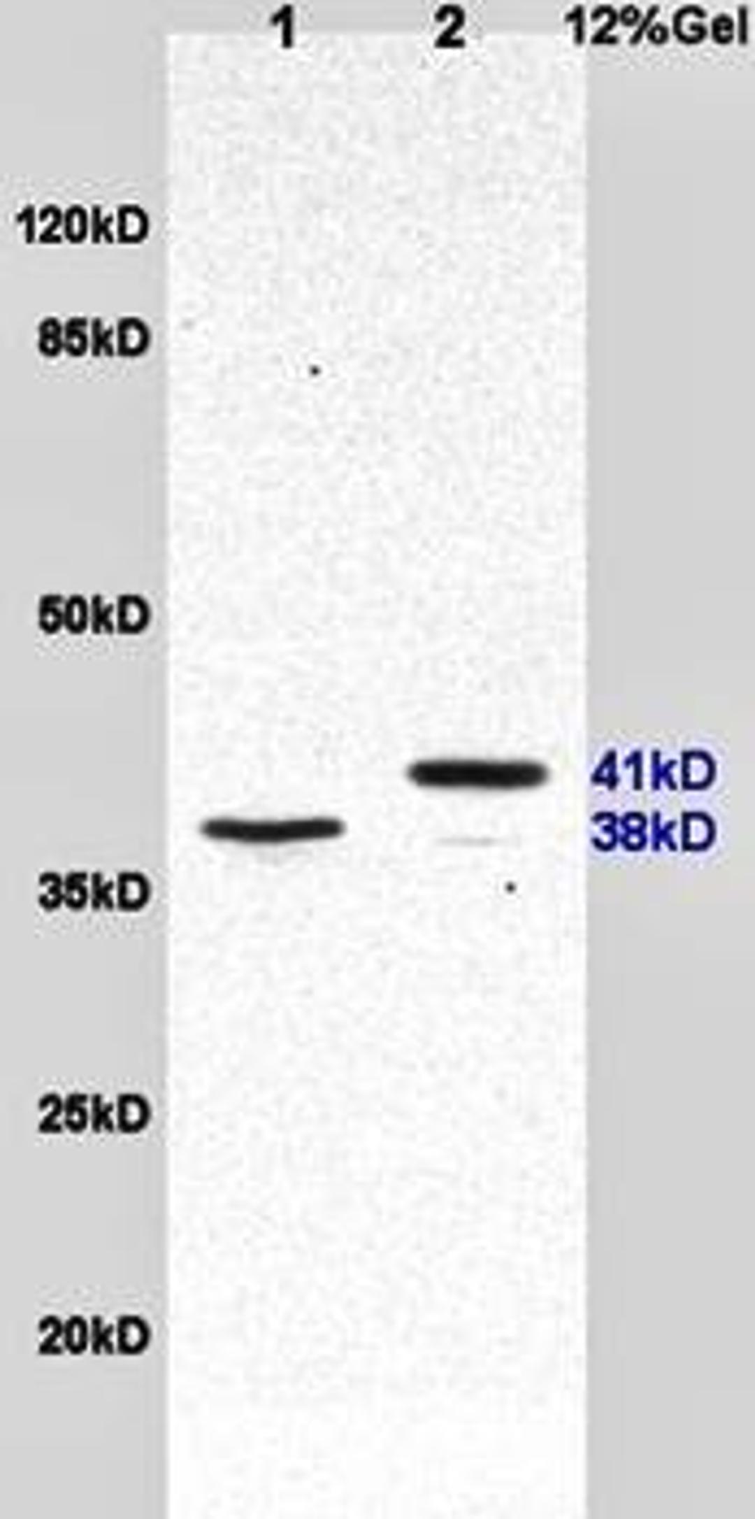 Western blot analysis of rat lung lysates (Lane1), human lung carcinoma lysates (Lane2) dilution at:1:200 using Surfactant Protein D antibody